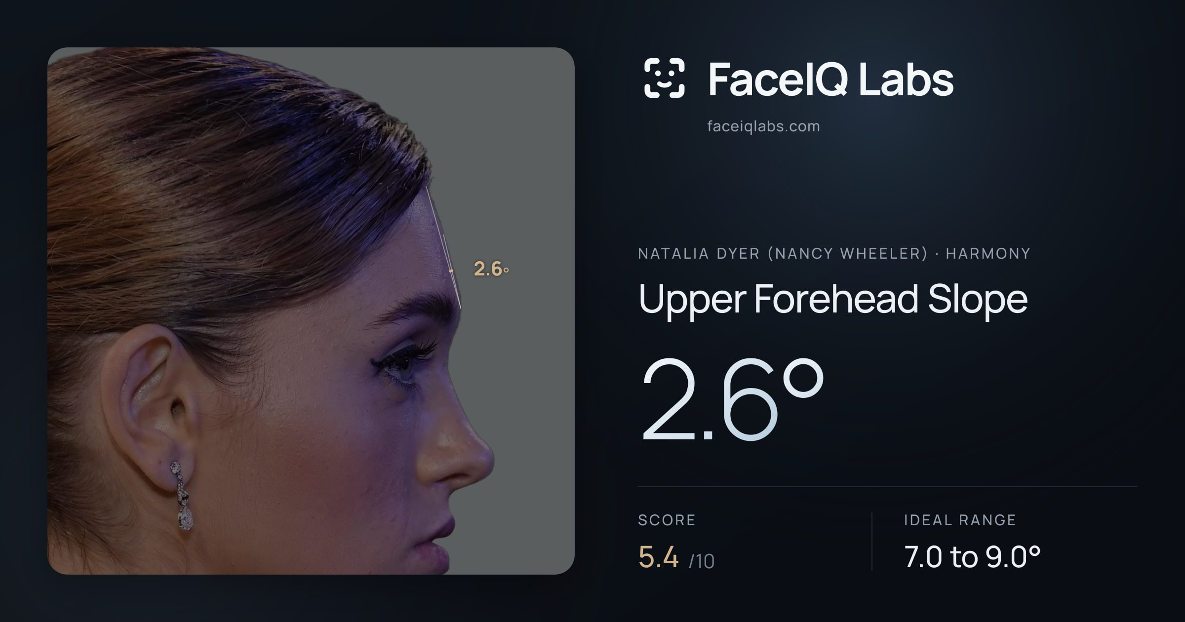 Natalia Dyer (Nancy Wheeler) Upper Forehead Slope: 2.6°, drawn on the photo