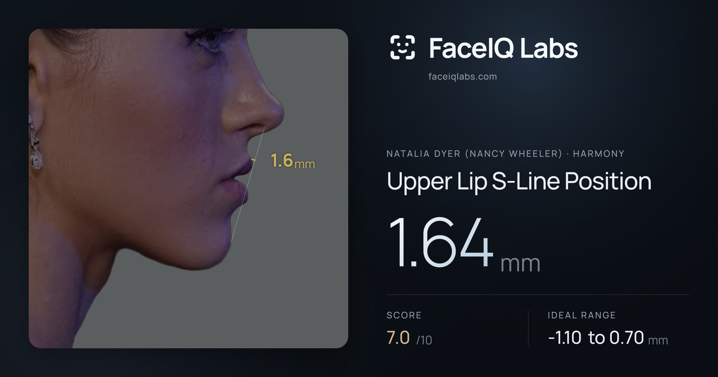 Natalia Dyer (Nancy Wheeler) Upper Lip S-Line Position: 1.64mm, drawn on the photo