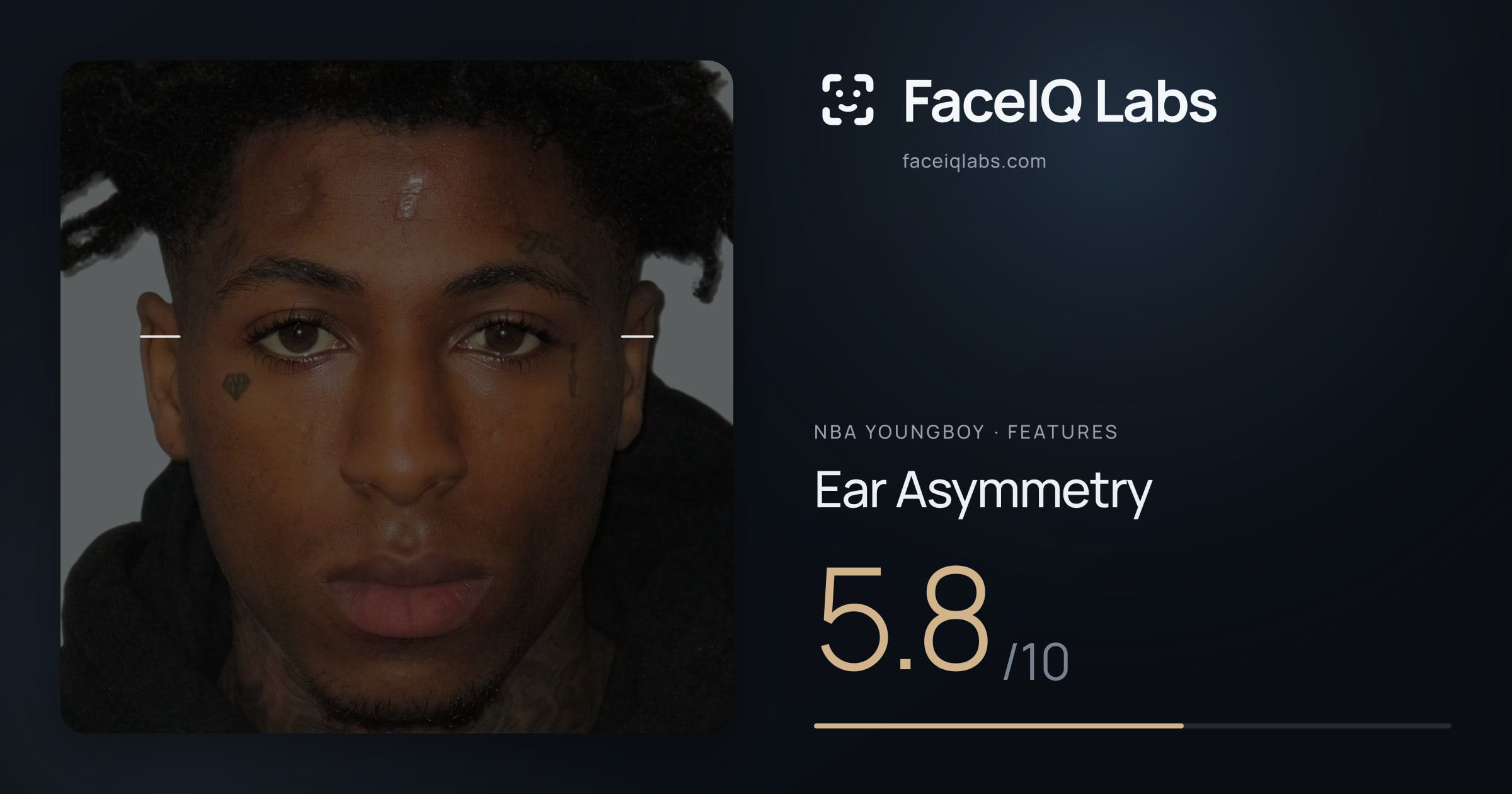 NBA YoungBoy Ear Asymmetry: 5.8/10, drawn on the photo