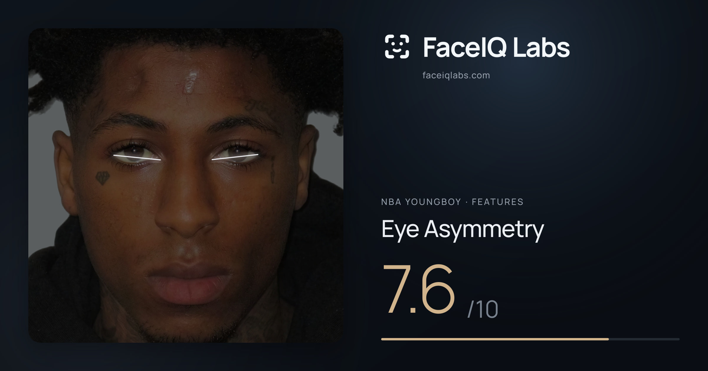 NBA YoungBoy Eye Asymmetry: 7.6/10, drawn on the photo