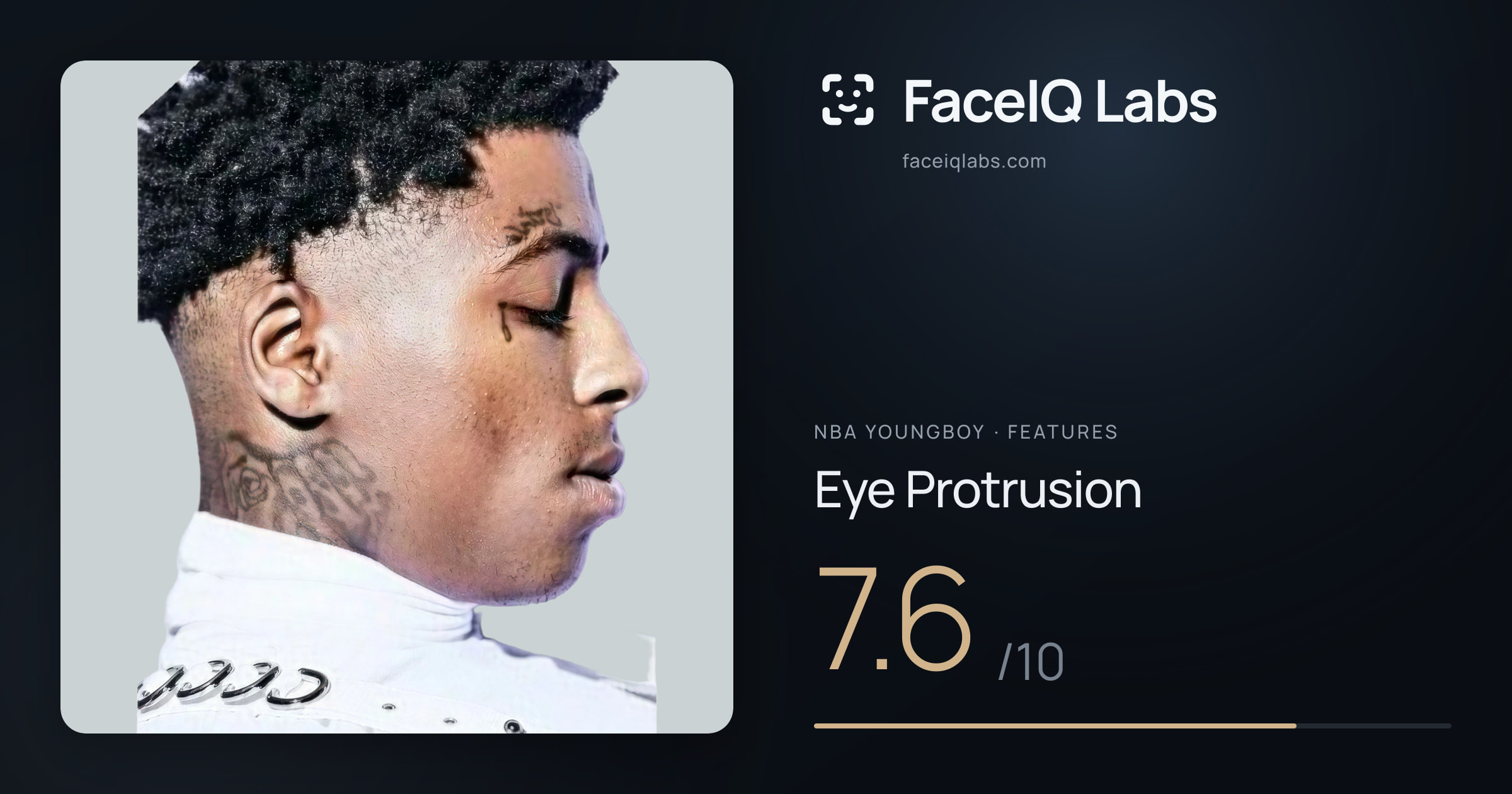 NBA YoungBoy Eye Protrusion: 7.6/10, drawn on the photo