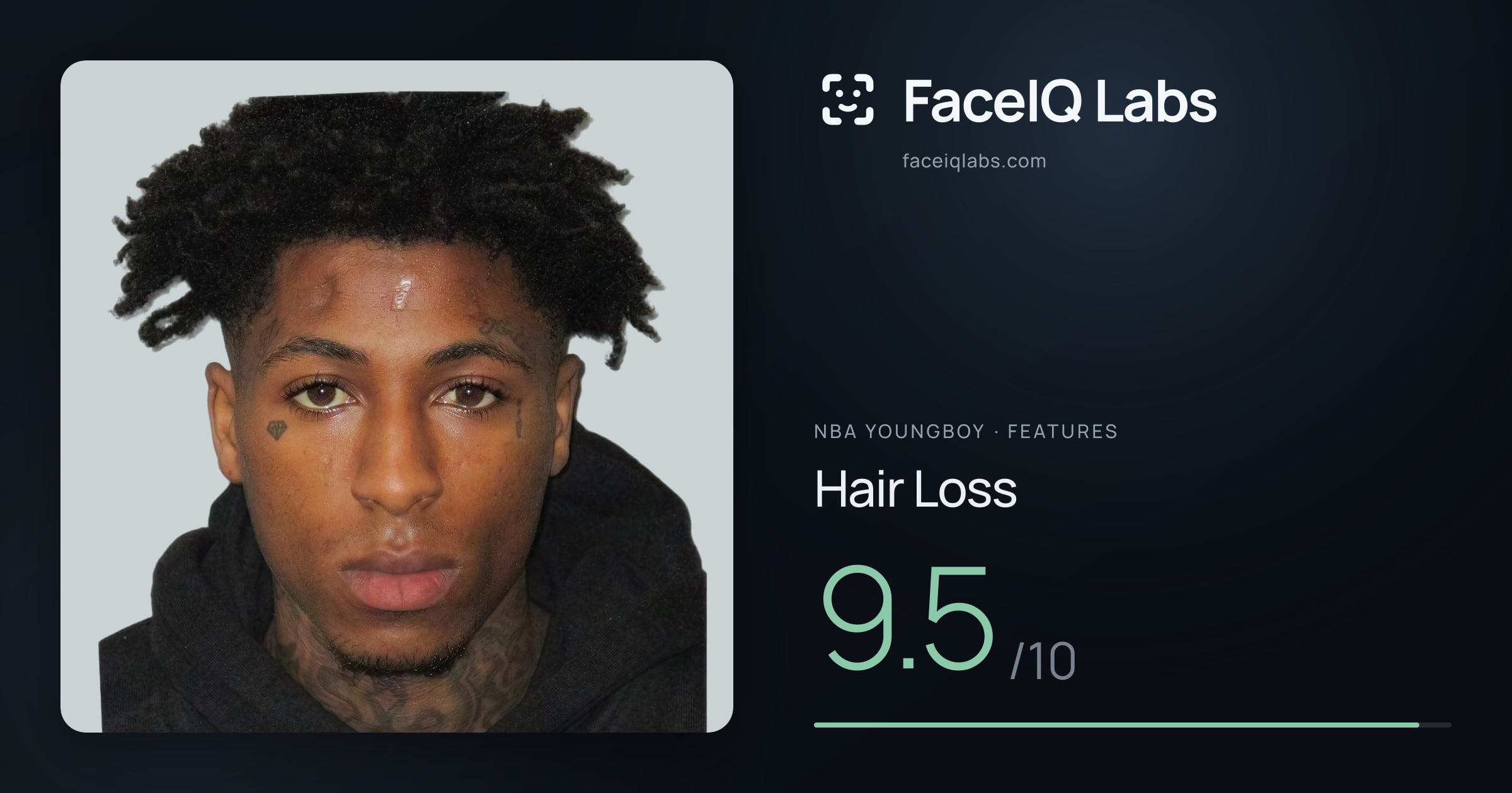 NBA YoungBoy Hair Loss: 9.5/10, drawn on the photo