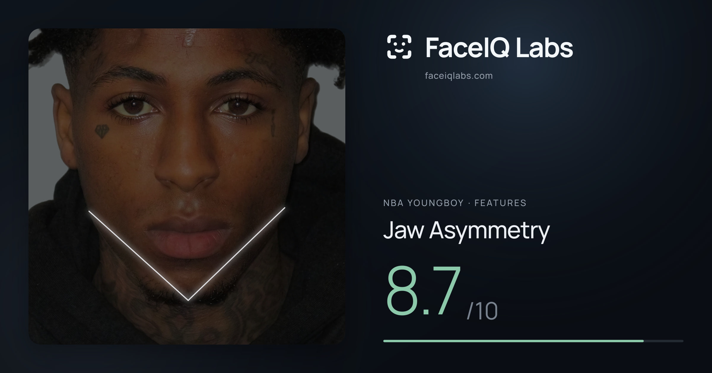 NBA YoungBoy Jaw Asymmetry: 8.7/10, drawn on the photo