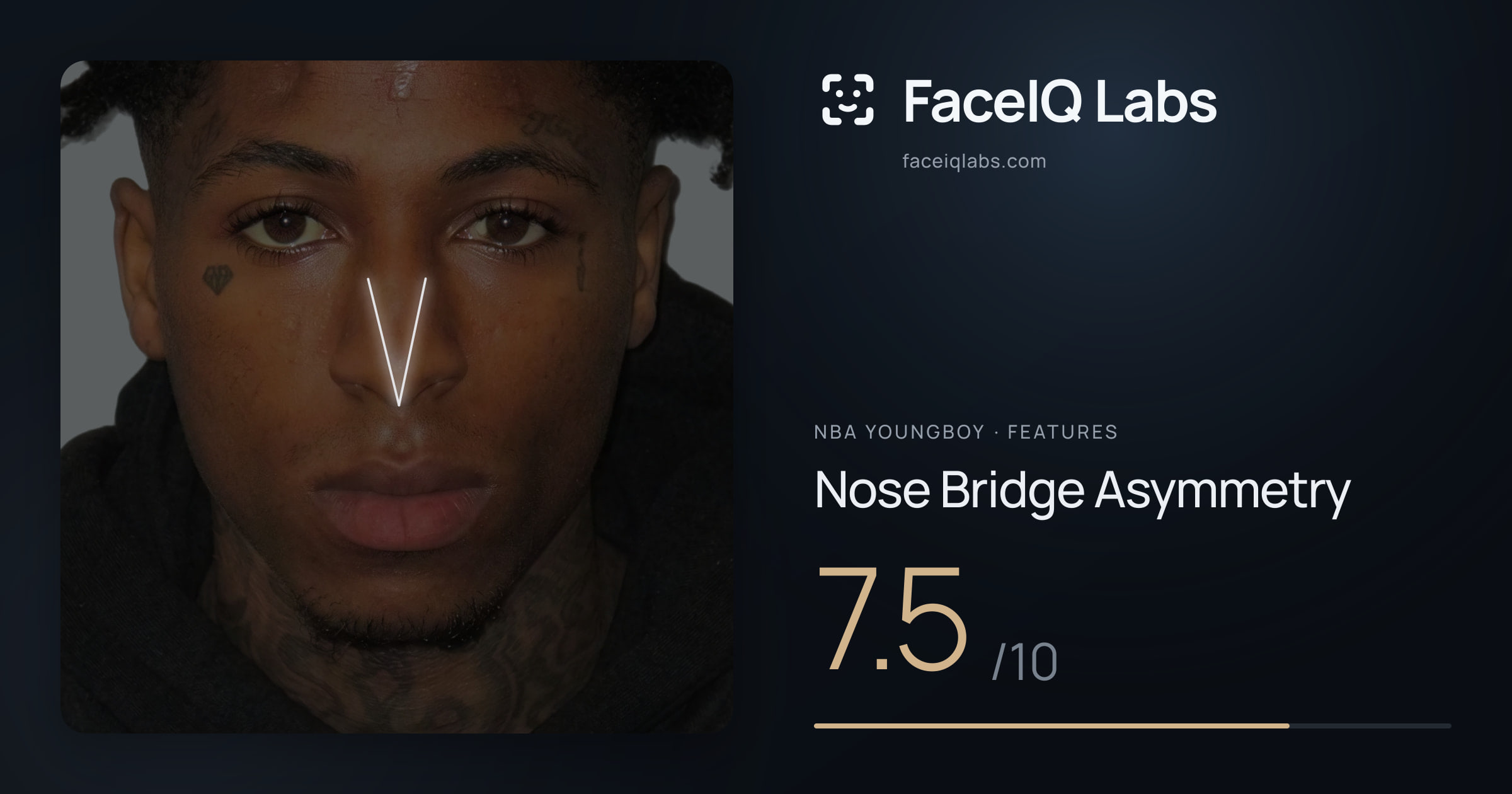 NBA YoungBoy Nose Bridge Asymmetry: 7.5/10, drawn on the photo