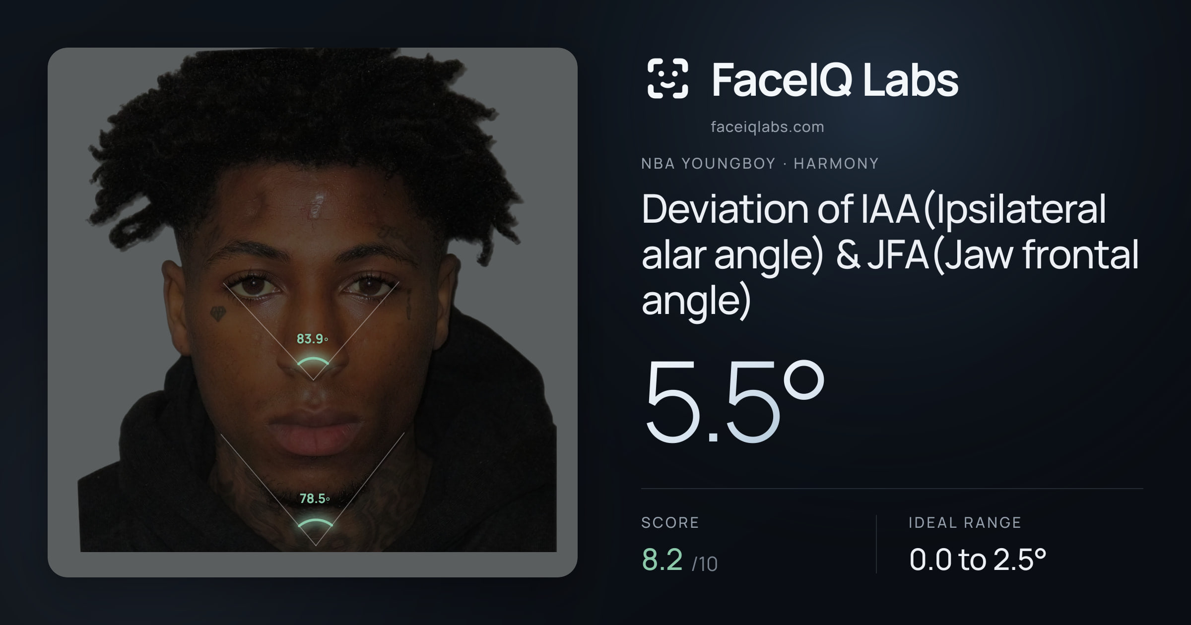 NBA YoungBoy Deviation of IAA(Ipsilateral alar angle) & JFA(Jaw frontal angle): 5.5°, drawn on the photo