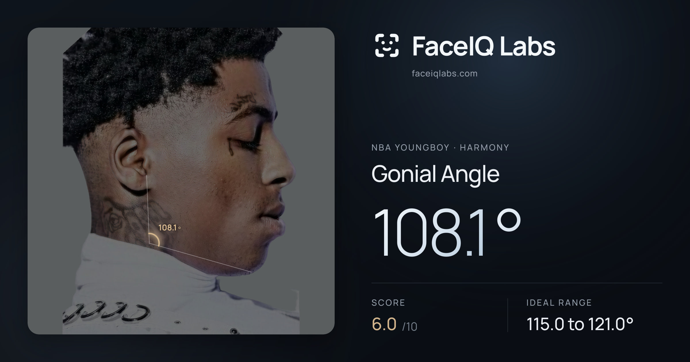 NBA YoungBoy Gonial Angle: 108.1°, drawn on the photo