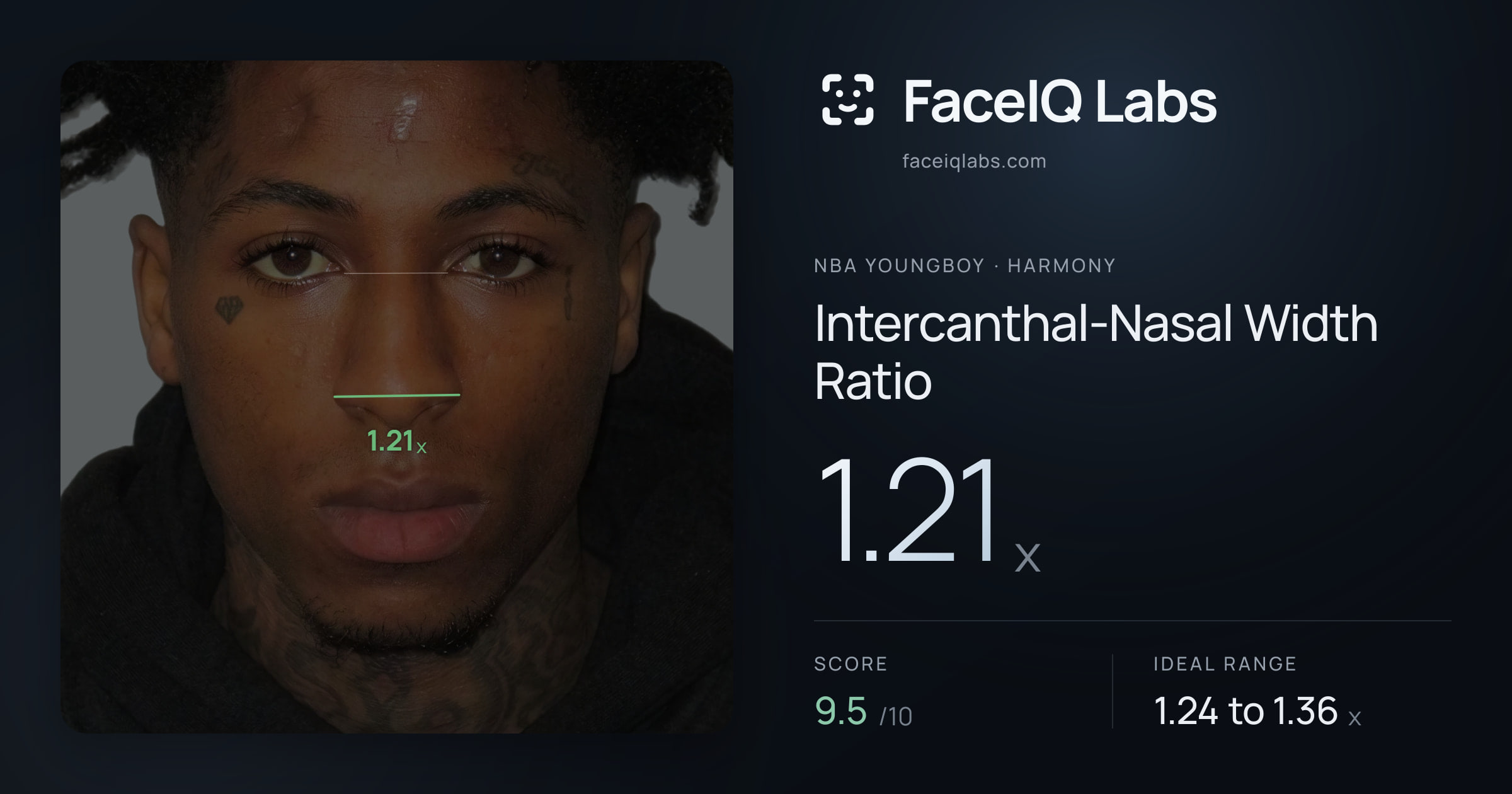 NBA YoungBoy Intercanthal-Nasal Width Ratio: 1.21x, drawn on the photo