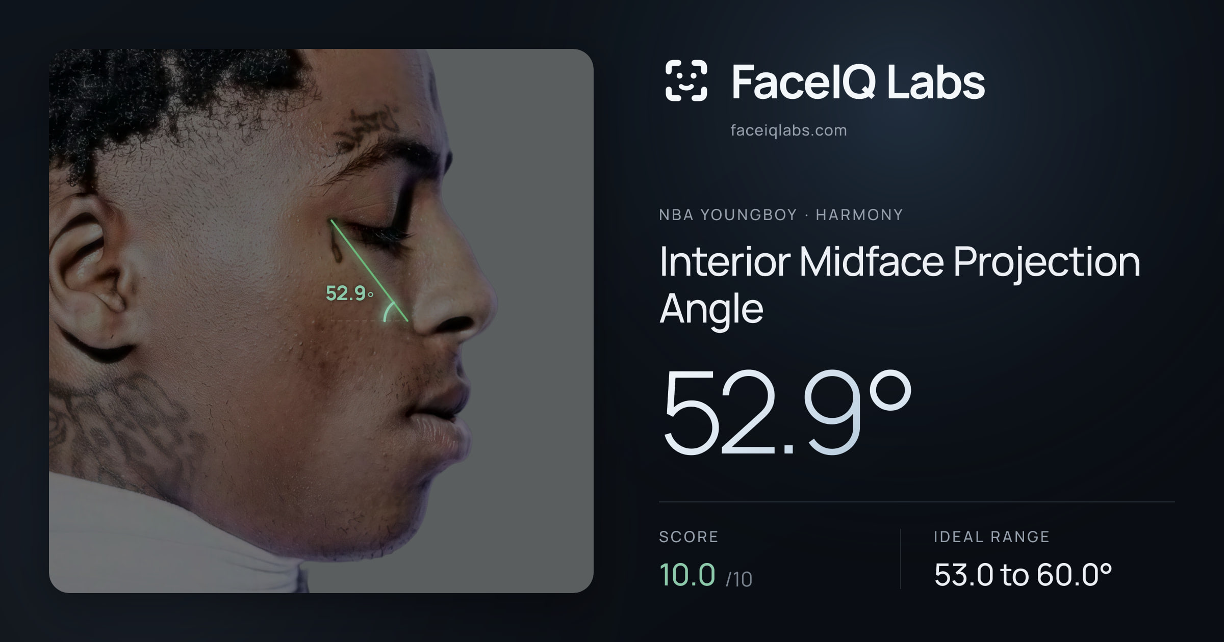 NBA YoungBoy Interior Midface Projection Angle: 52.9°, drawn on the photo