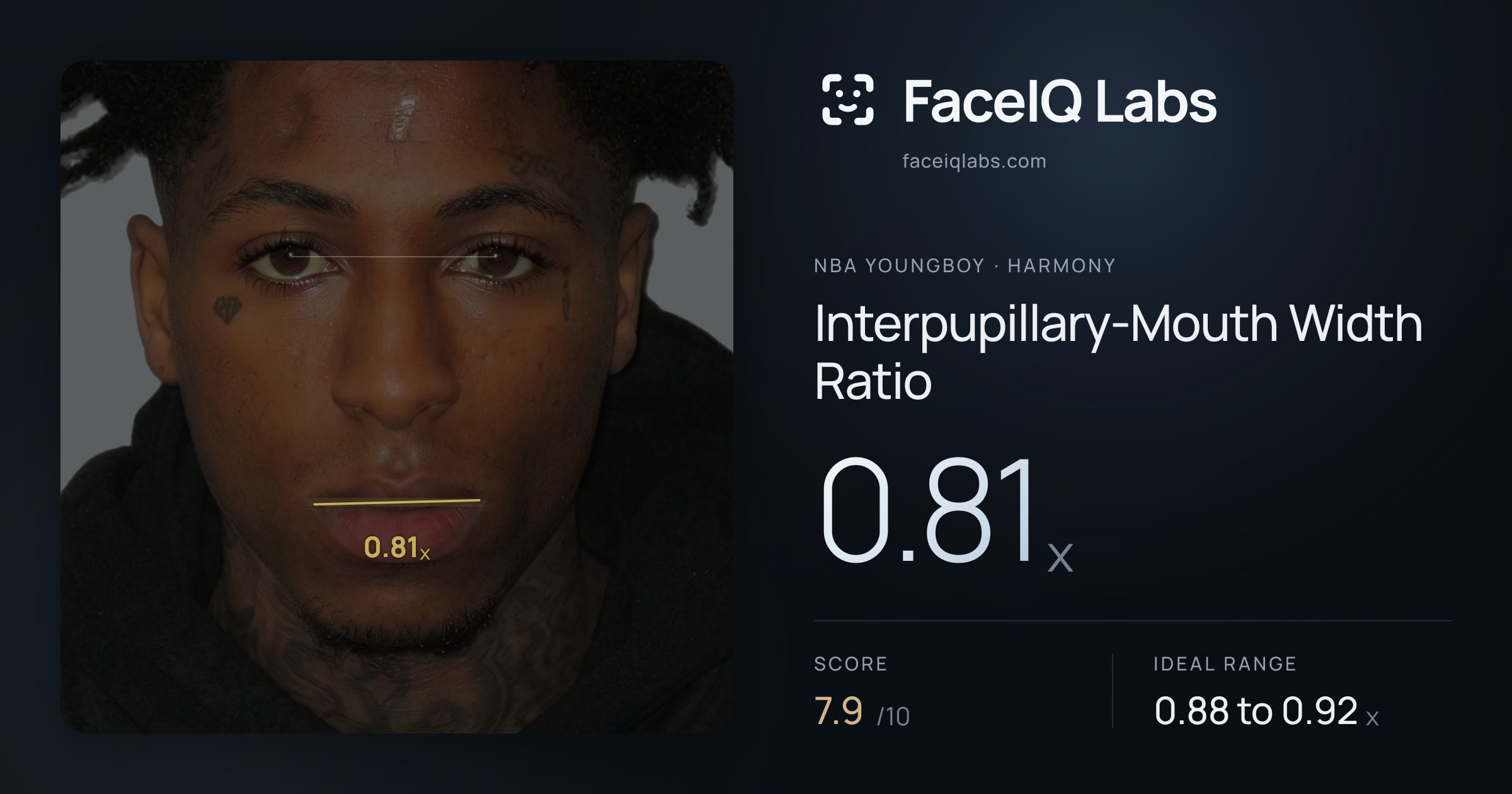 NBA YoungBoy Interpupillary-Mouth Width Ratio: 0.81x, drawn on the photo