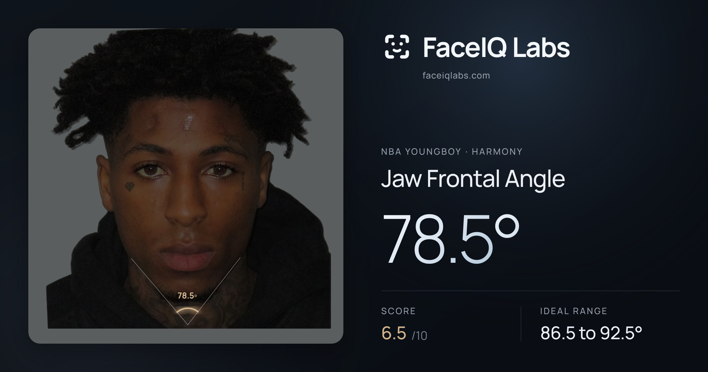 NBA YoungBoy Jaw Frontal Angle: 78.5°, drawn on the photo