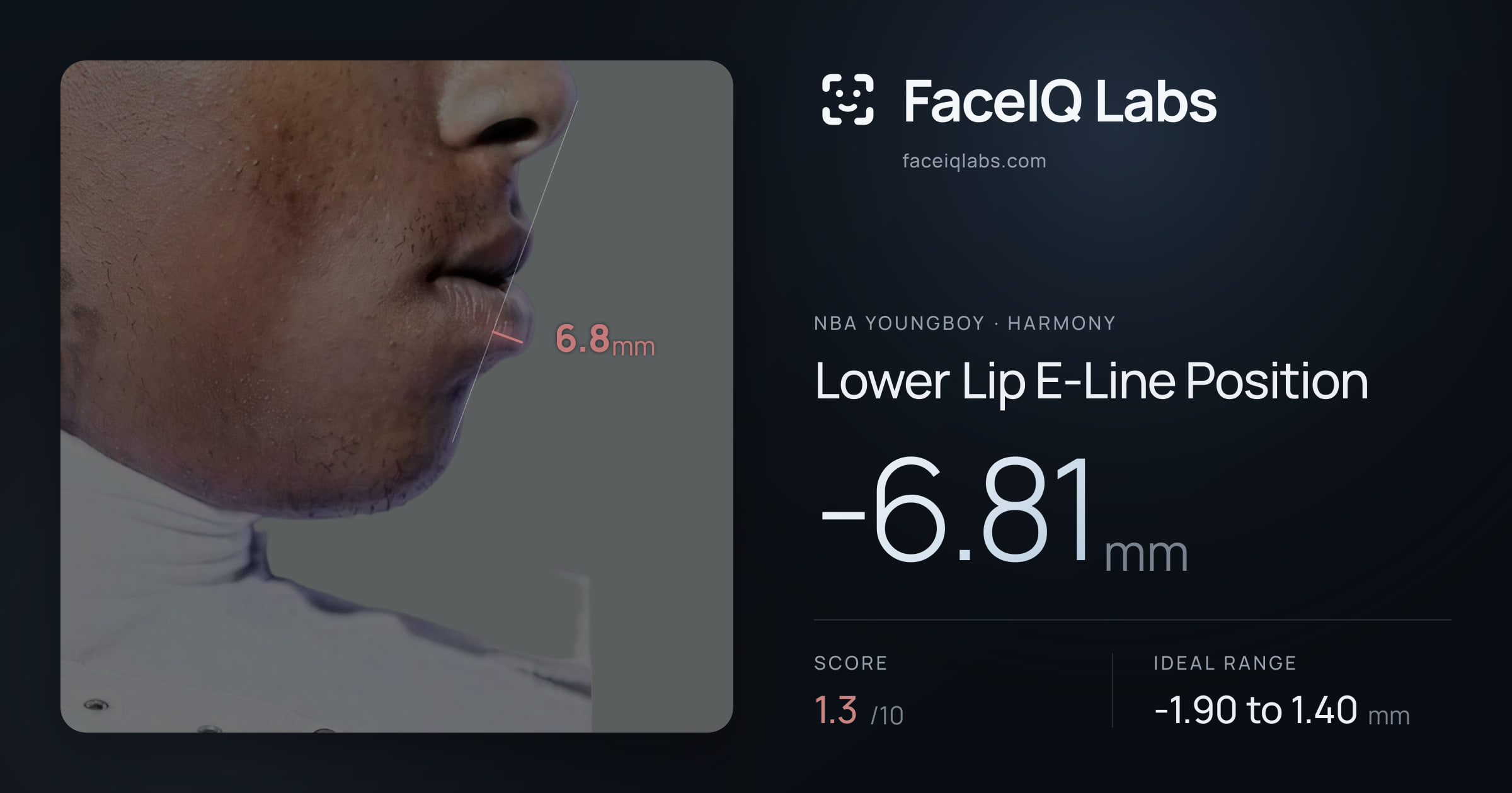 NBA YoungBoy Lower Lip E-Line Position: -6.81mm, drawn on the photo