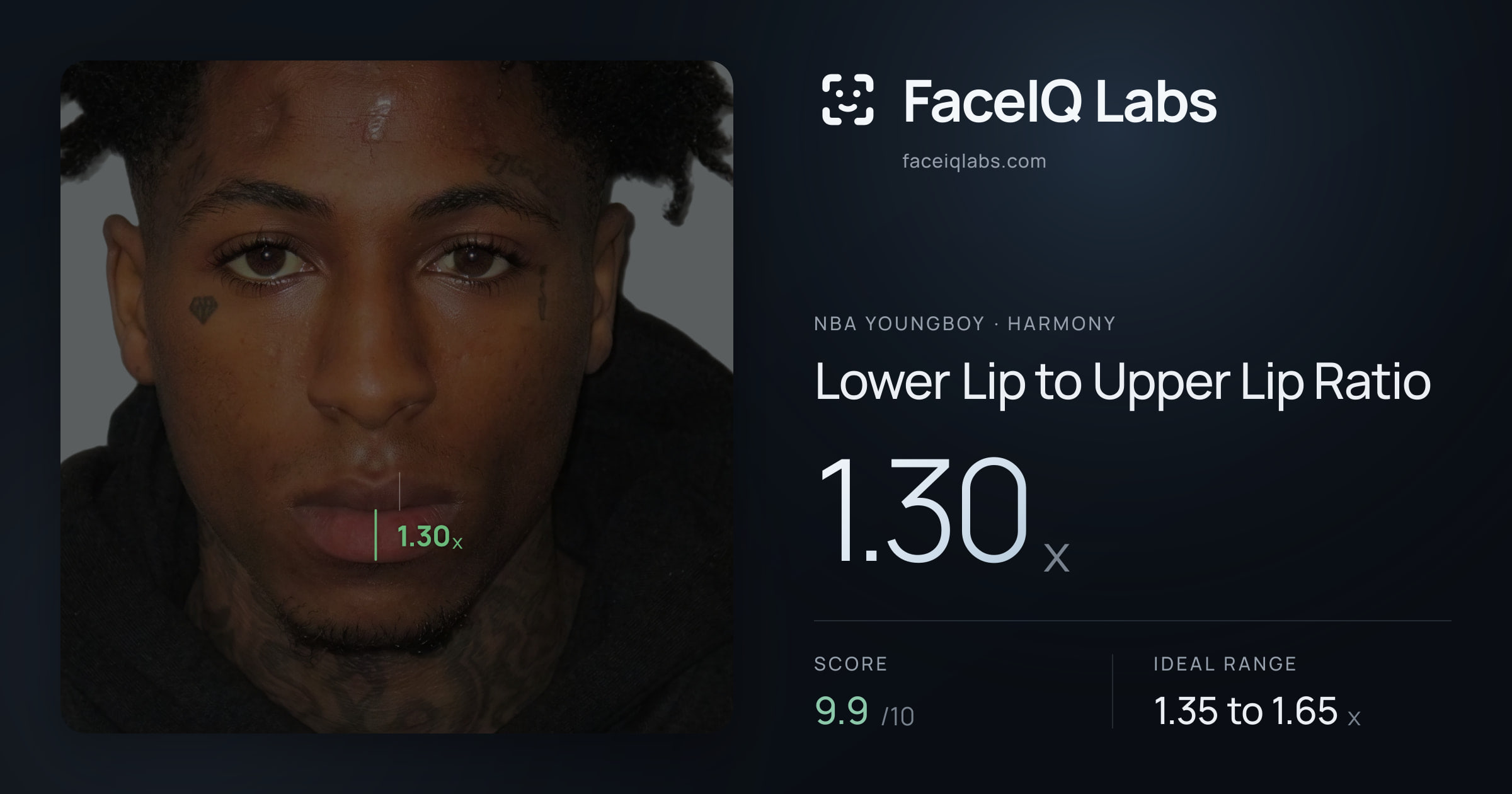 NBA YoungBoy Lower Lip to Upper Lip Ratio: 1.30x, drawn on the photo