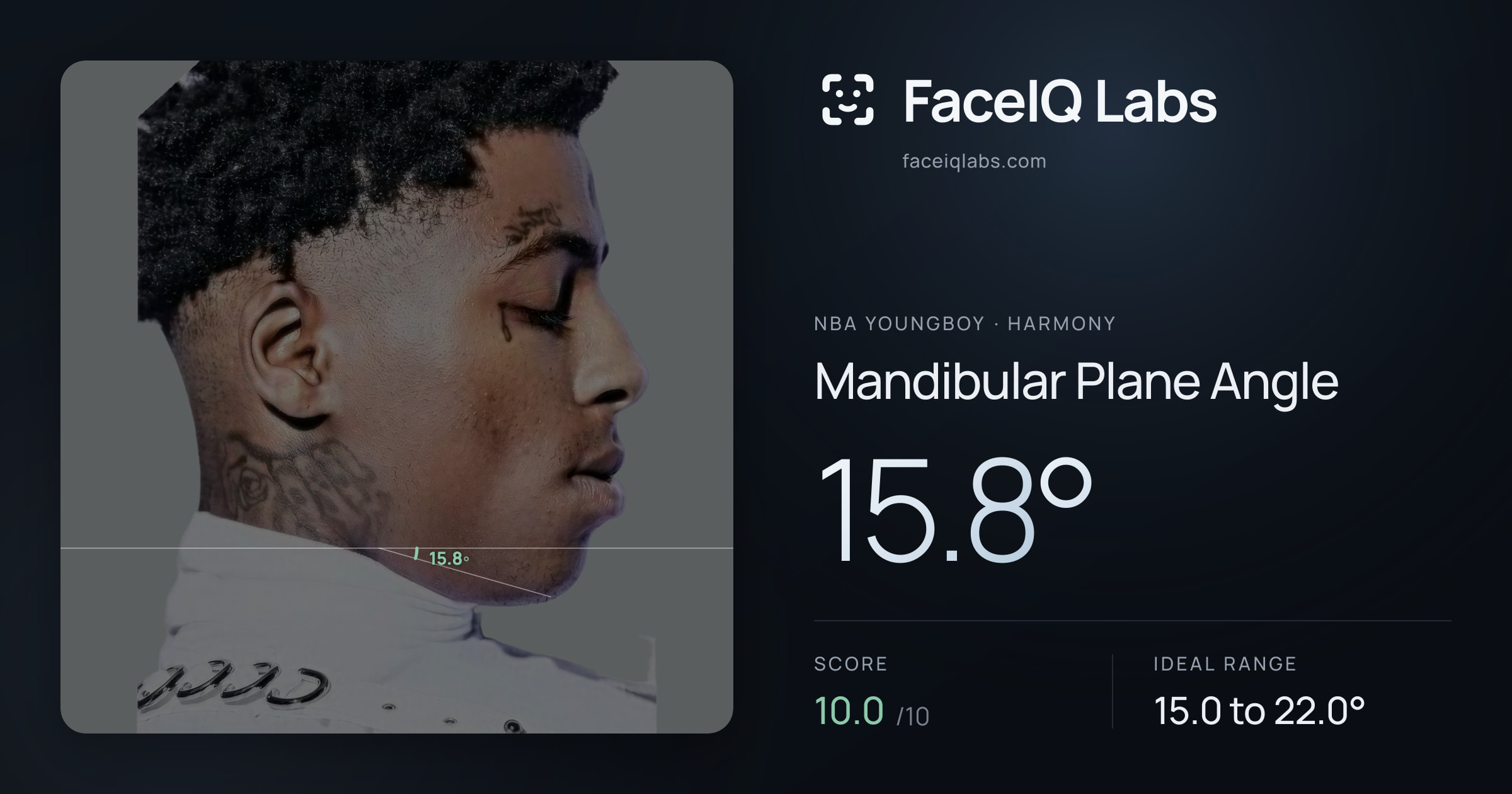 NBA YoungBoy Mandibular Plane Angle: 15.8°, drawn on the photo