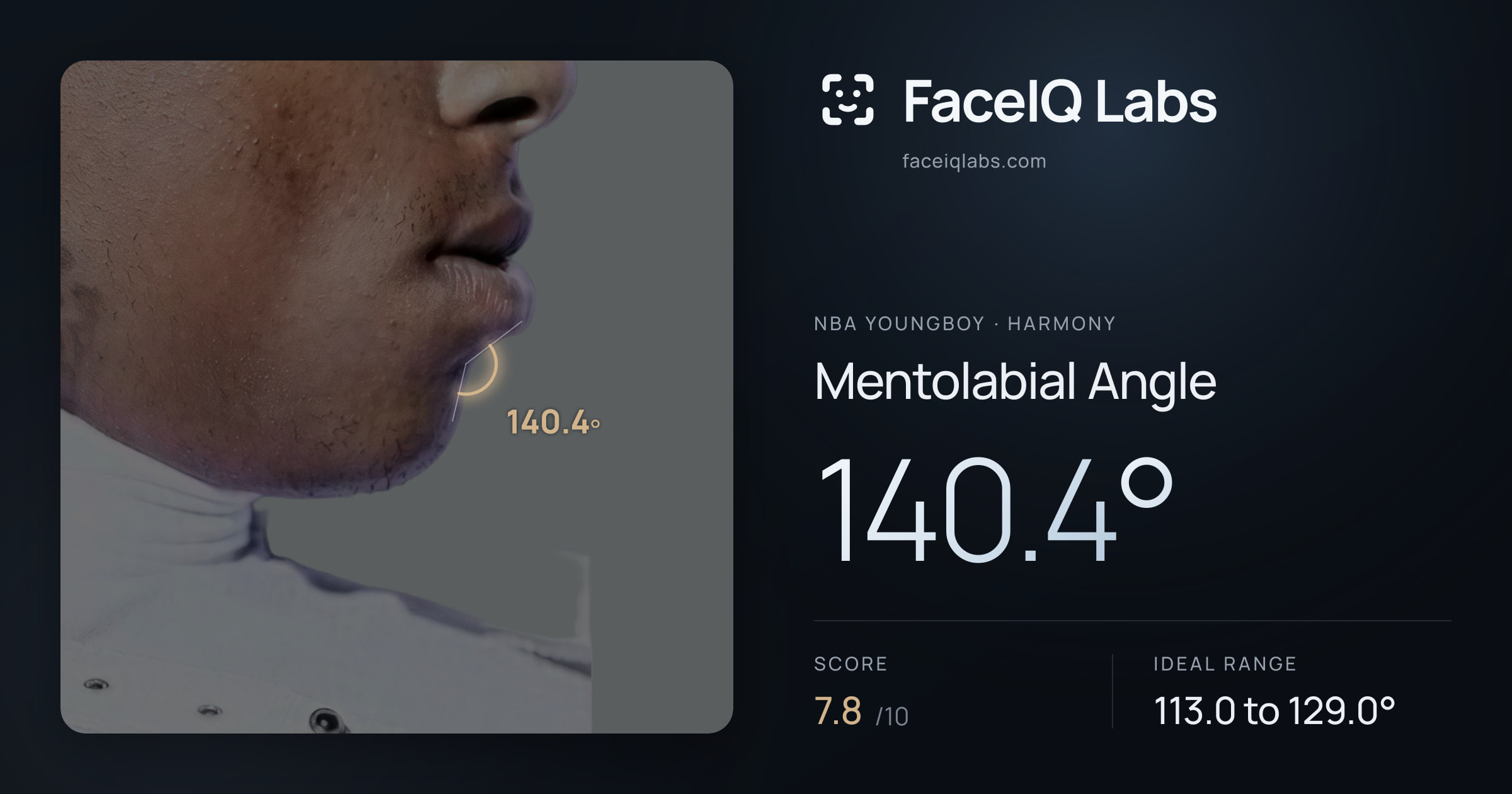 NBA YoungBoy Mentolabial Angle: 140.4°, drawn on the photo