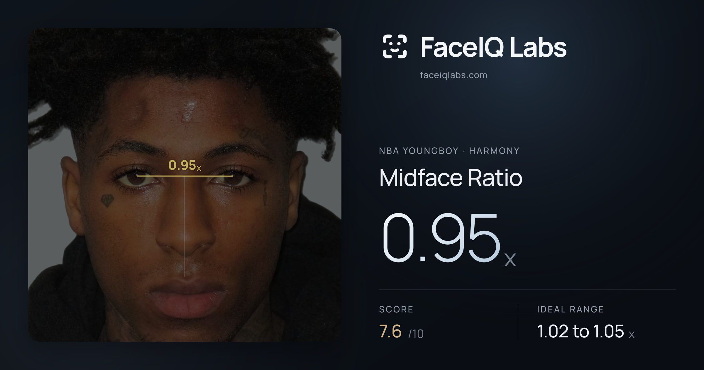 NBA YoungBoy Midface Ratio: 0.95x, drawn on the photo
