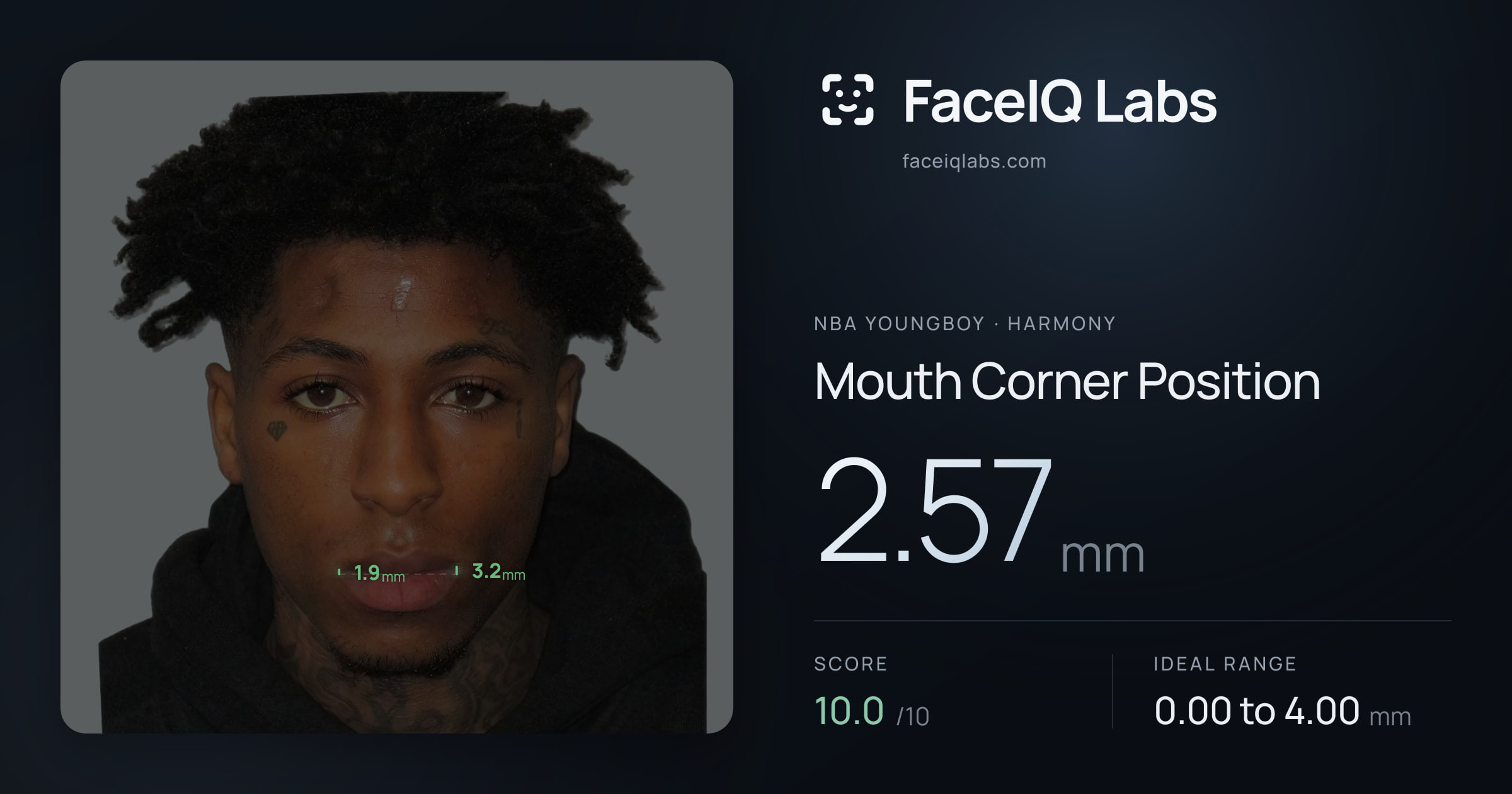 NBA YoungBoy Mouth Corner Position: 2.57mm, drawn on the photo