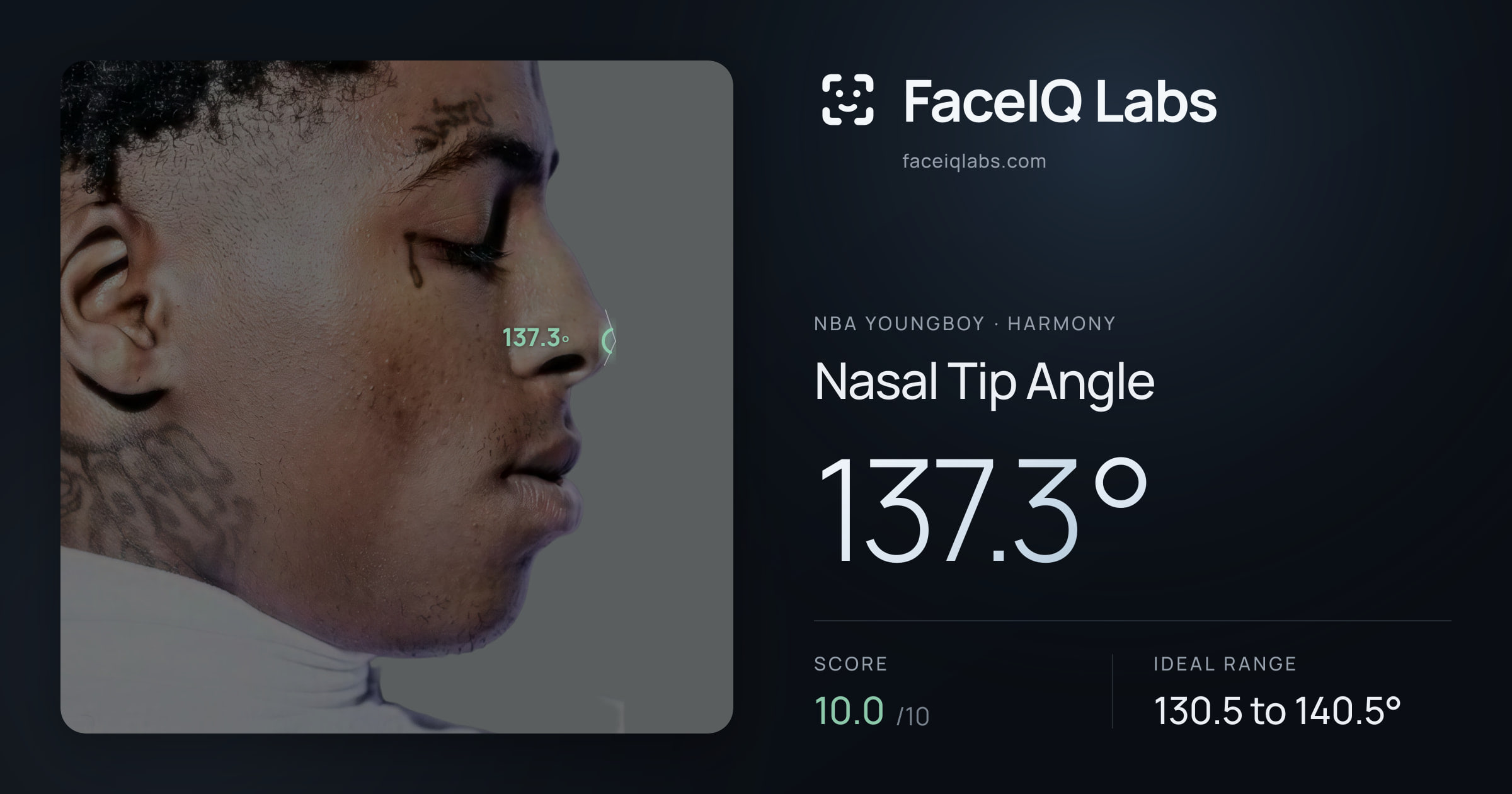 NBA YoungBoy Nasal Tip Angle: 137.3°, drawn on the photo