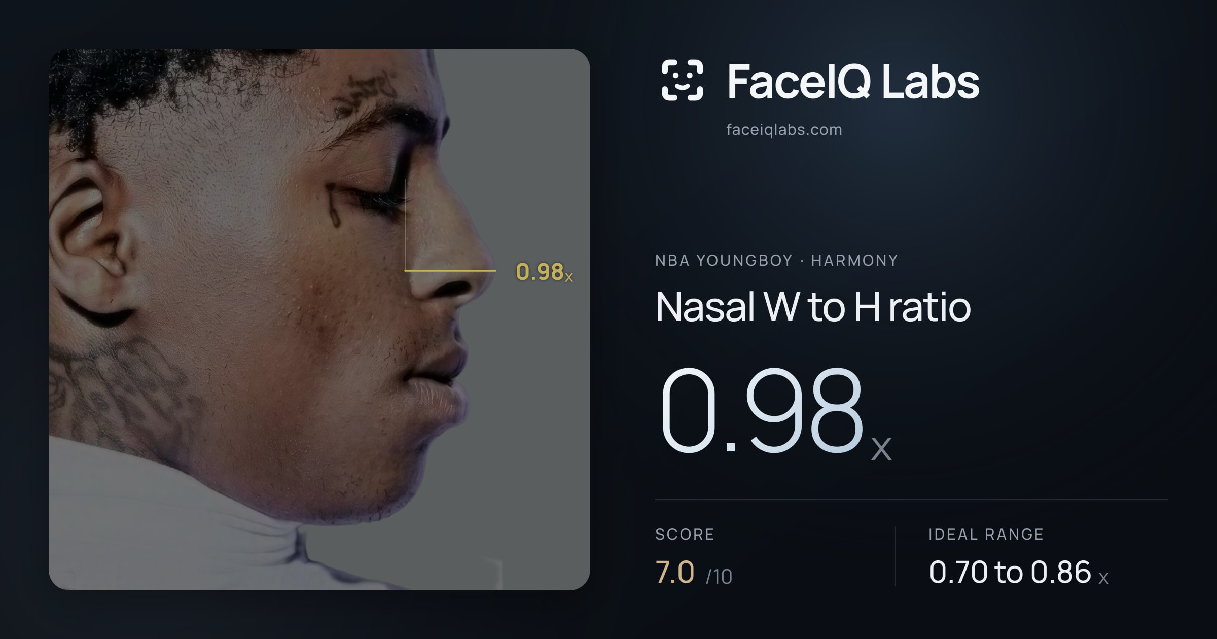 NBA YoungBoy Nasal W to H ratio: 0.98x, drawn on the photo