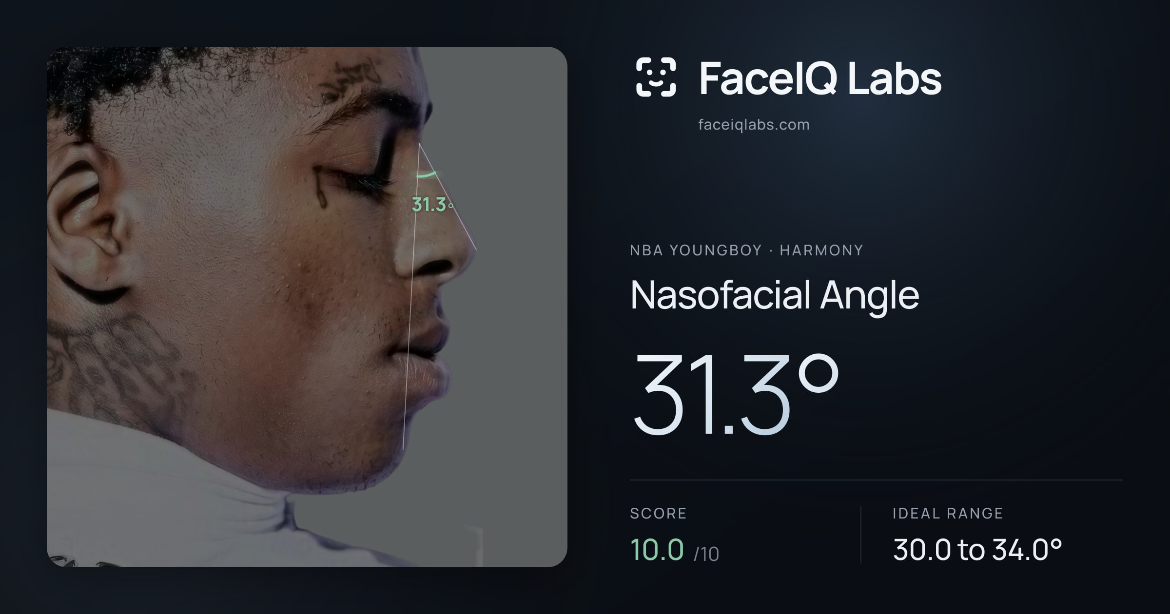 NBA YoungBoy Nasofacial Angle: 31.3°, drawn on the photo