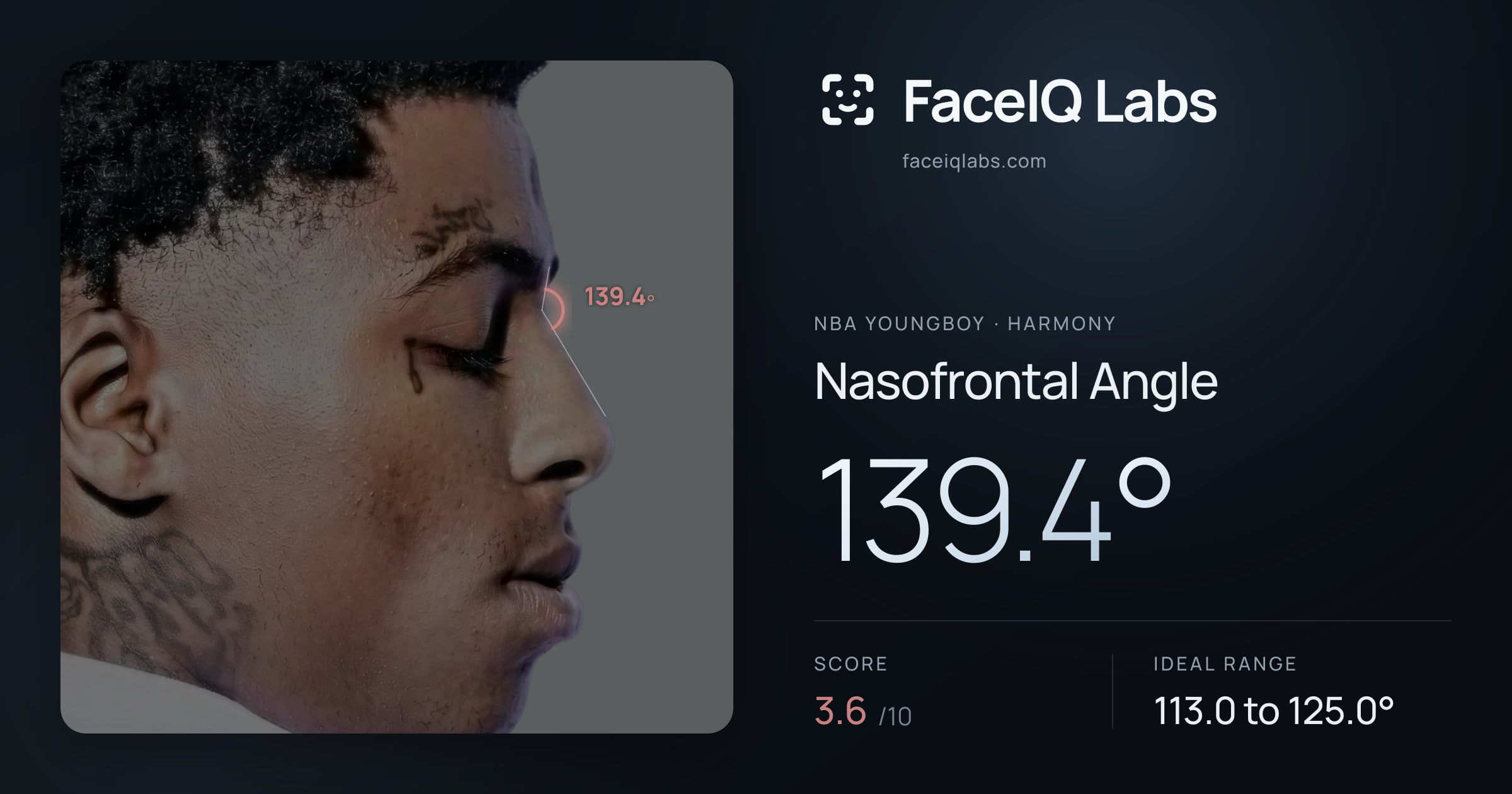 NBA YoungBoy Nasofrontal Angle: 139.4°, drawn on the photo