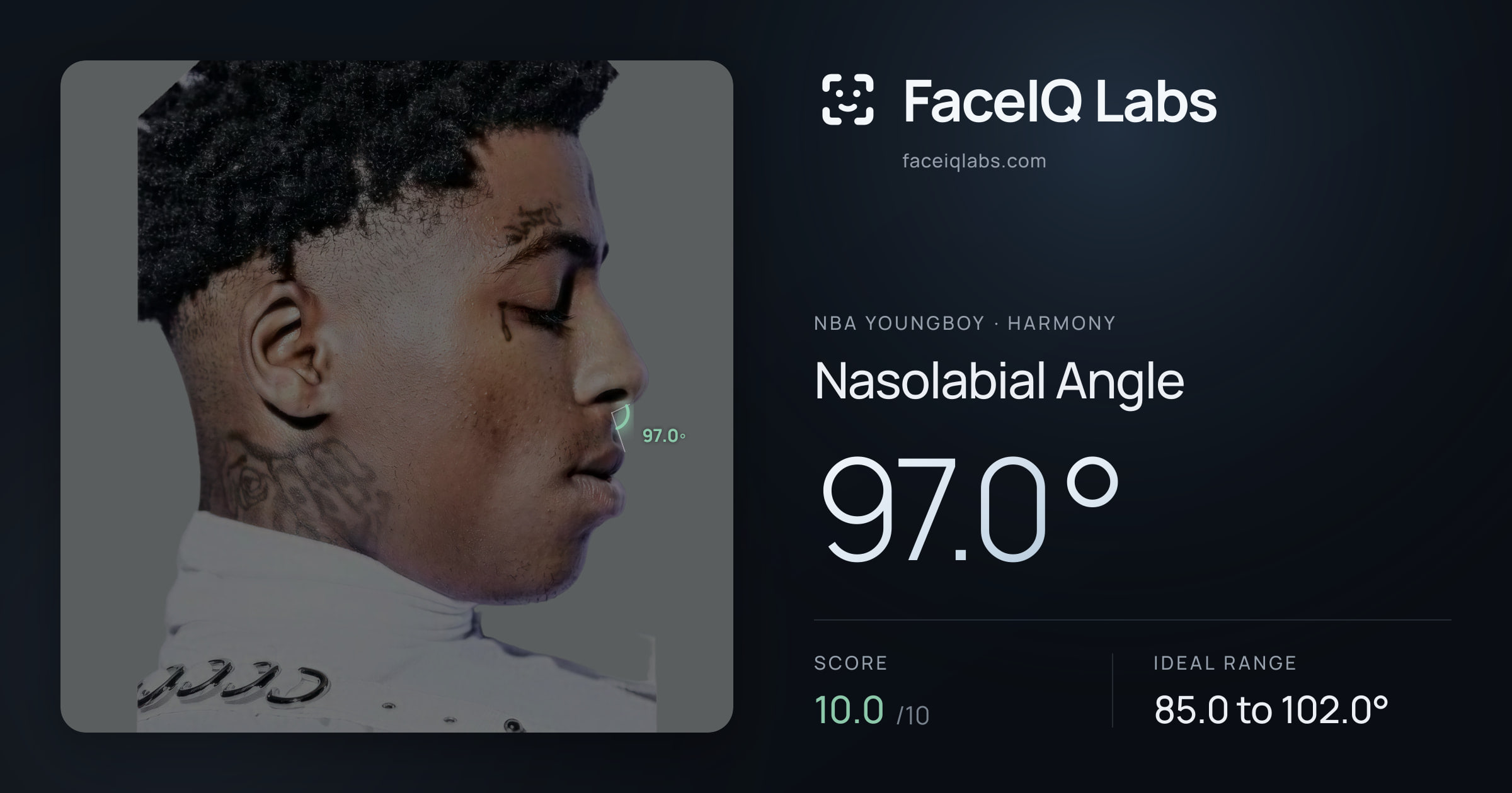 NBA YoungBoy Nasolabial Angle: 97.0°, drawn on the photo
