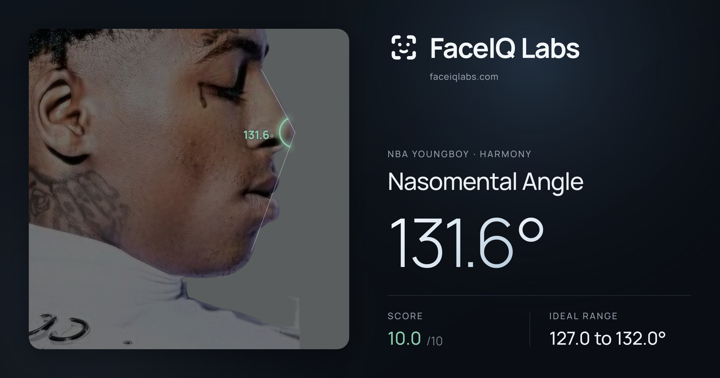 NBA YoungBoy Nasomental Angle: 131.6°, drawn on the photo