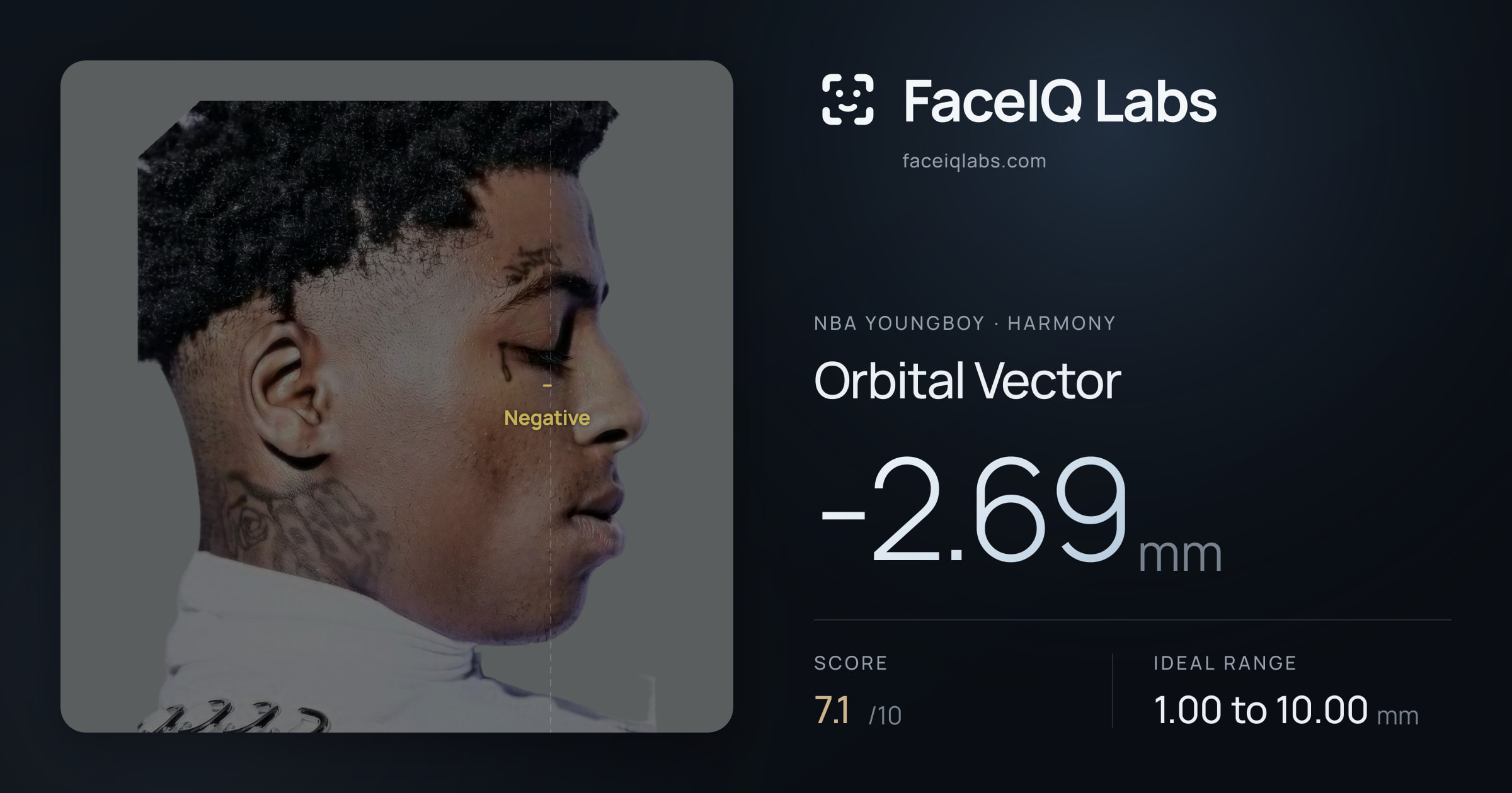 NBA YoungBoy Orbital Vector: -2.69mm, drawn on the photo
