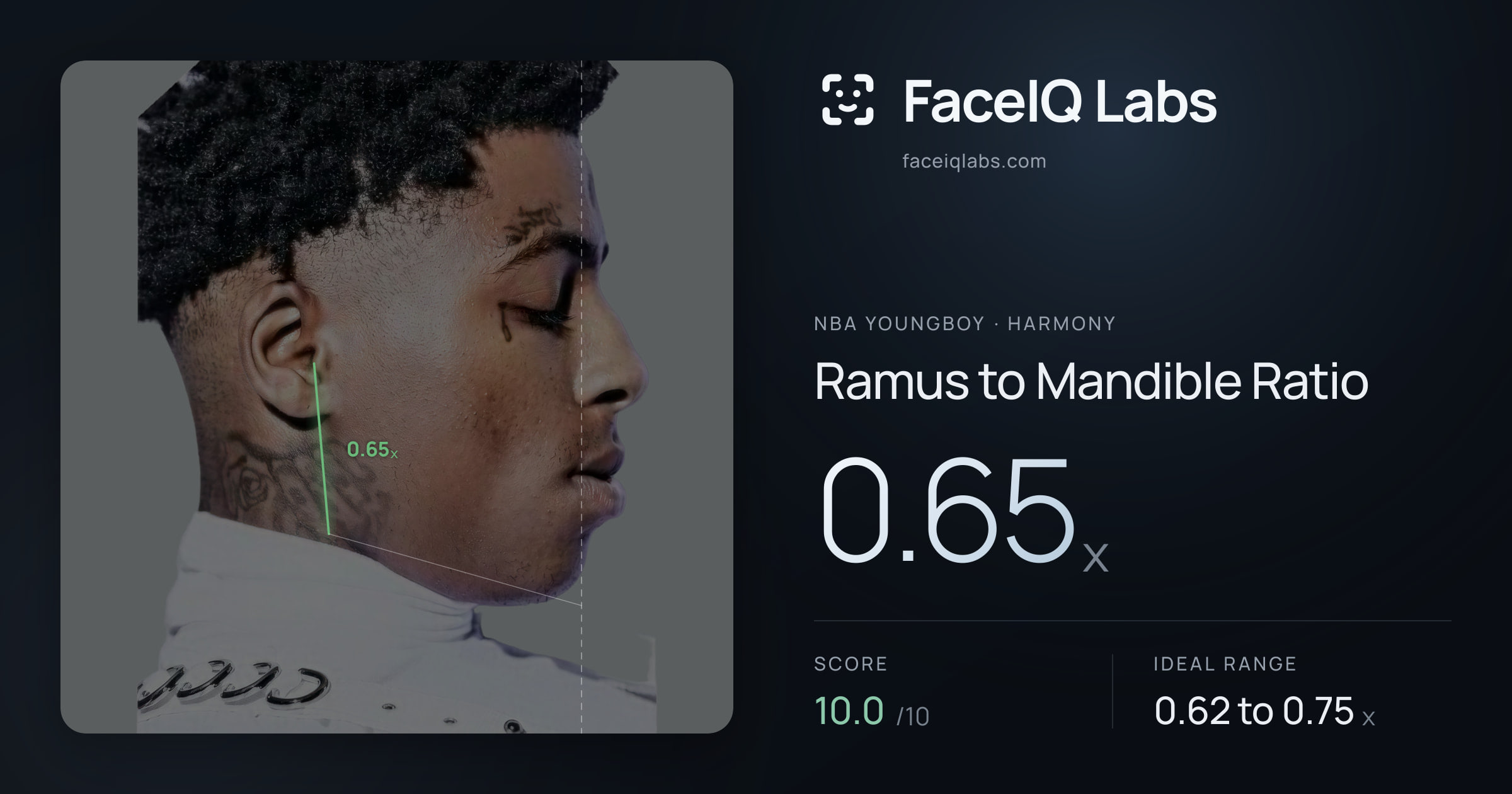 NBA YoungBoy Ramus to Mandible Ratio: 0.65x, drawn on the photo