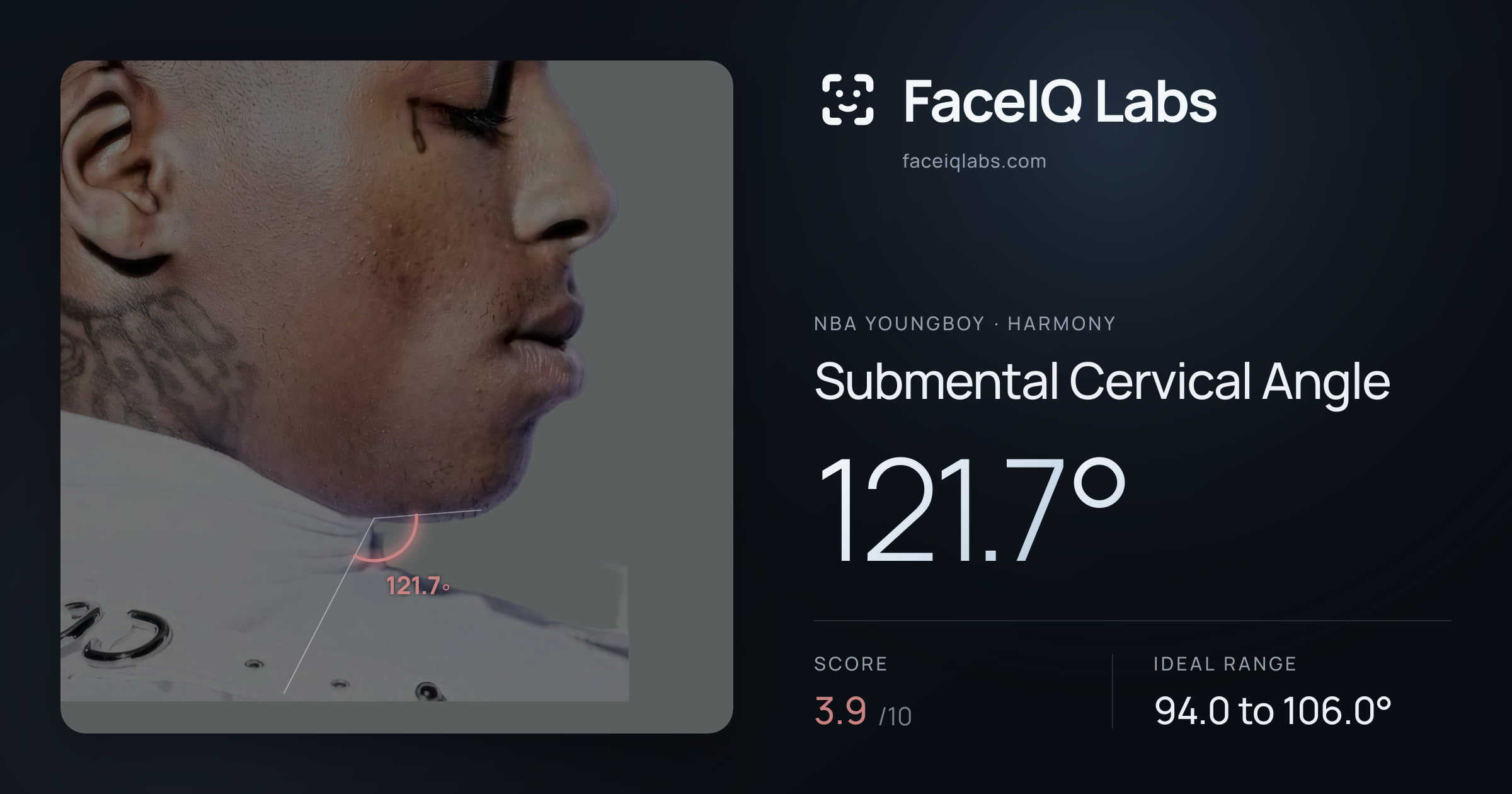 NBA YoungBoy Submental Cervical Angle: 121.7°, drawn on the photo