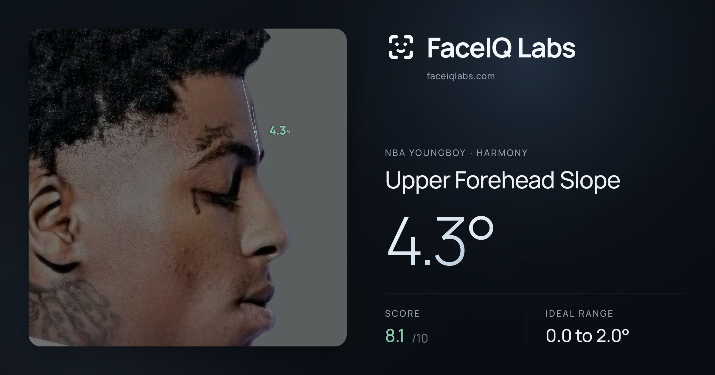 NBA YoungBoy Upper Forehead Slope: 4.3°, drawn on the photo