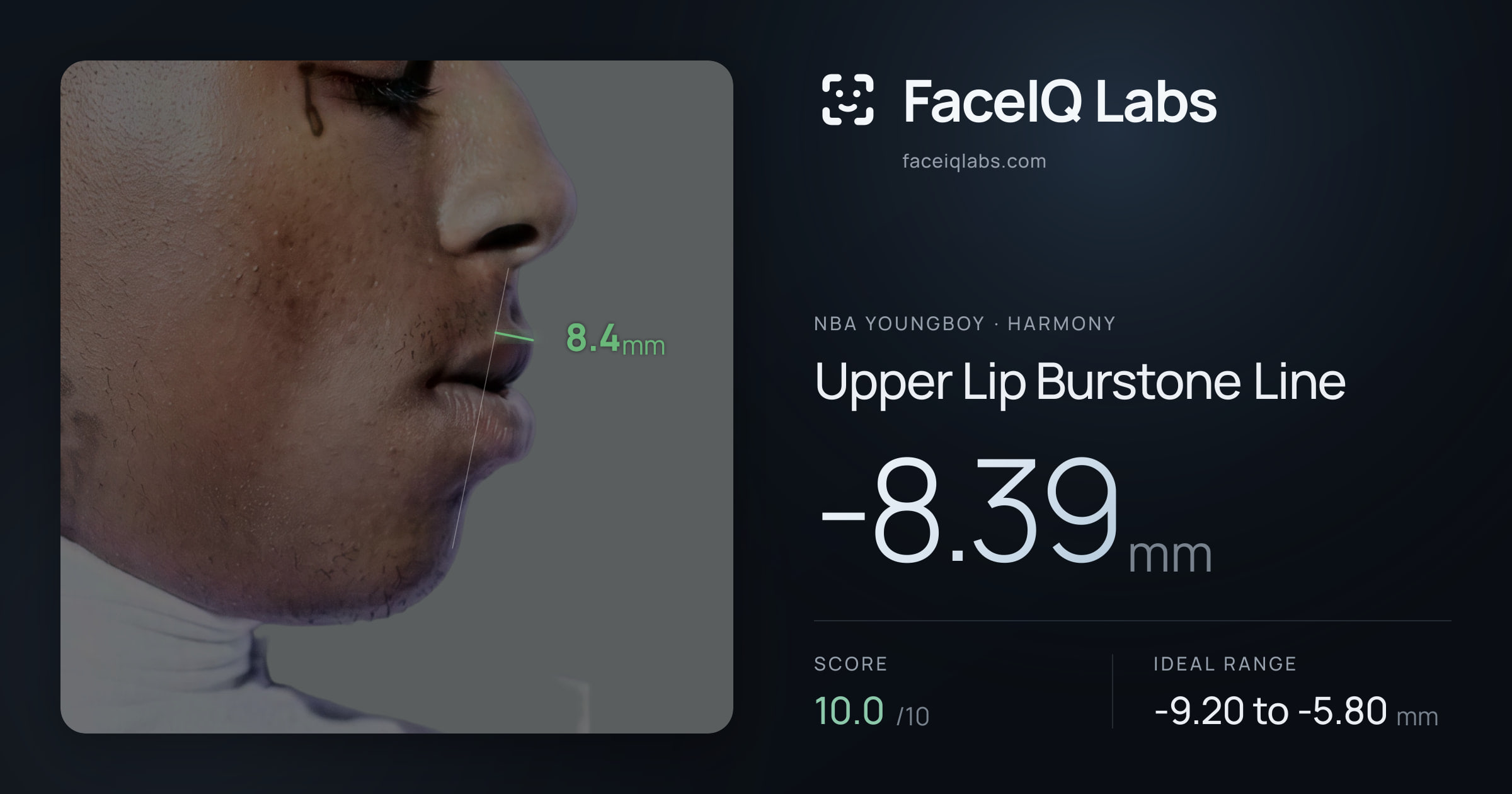NBA YoungBoy Upper Lip Burstone Line: -8.39mm, drawn on the photo