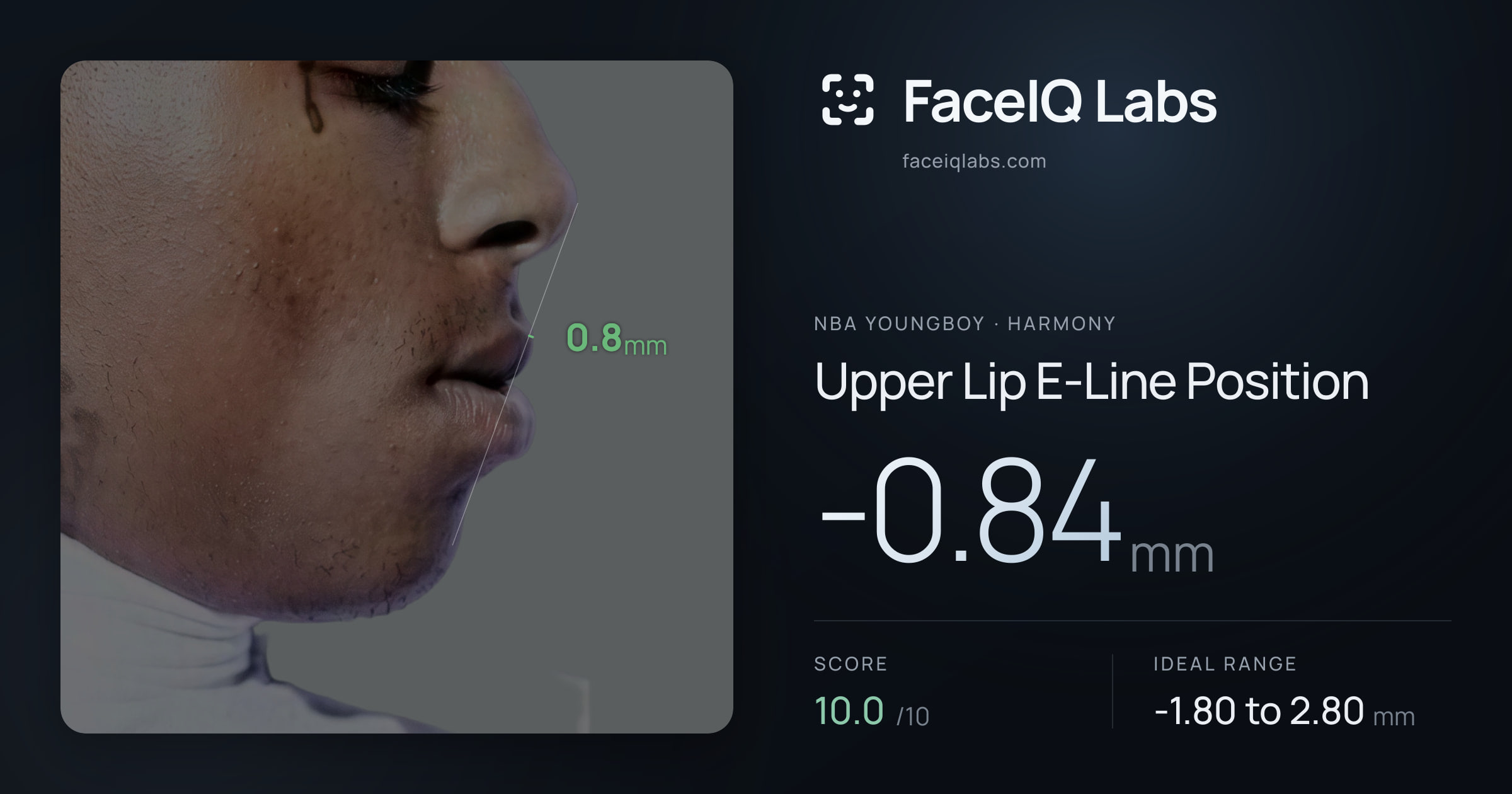 NBA YoungBoy Upper Lip E-Line Position: -0.84mm, drawn on the photo