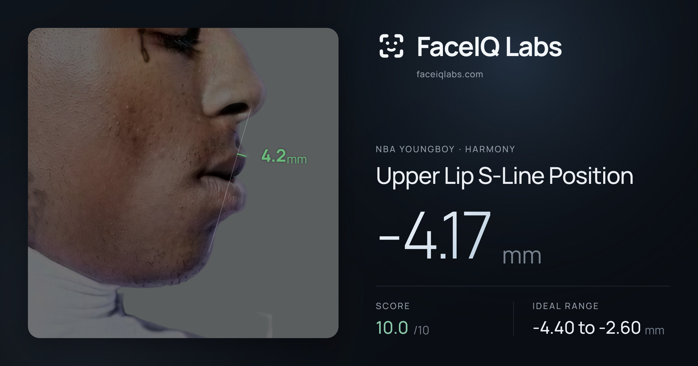 NBA YoungBoy Upper Lip S-Line Position: -4.17mm, drawn on the photo