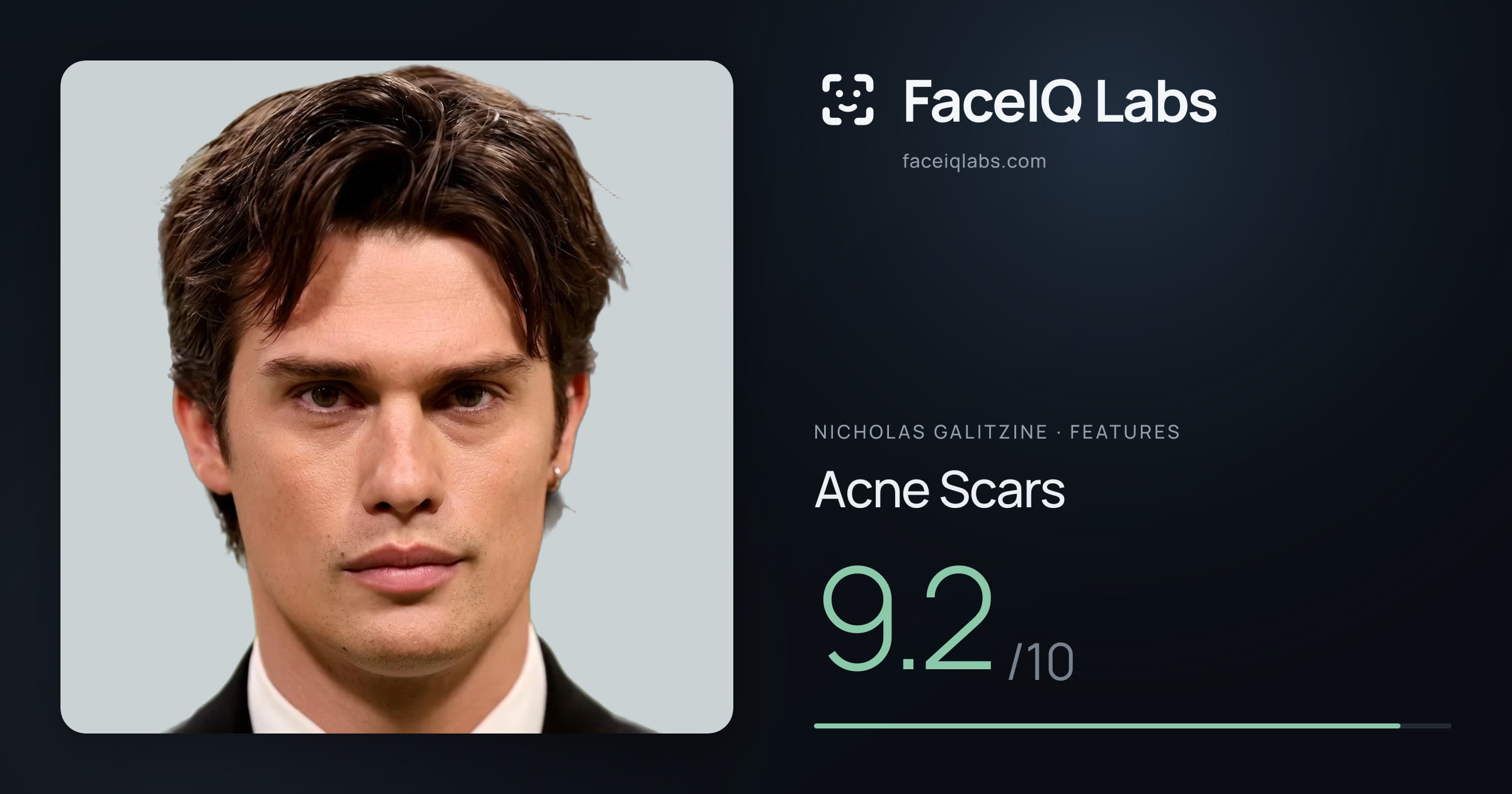 Nicholas Galitzine Acne Scars: 9.2/10, drawn on the photo
