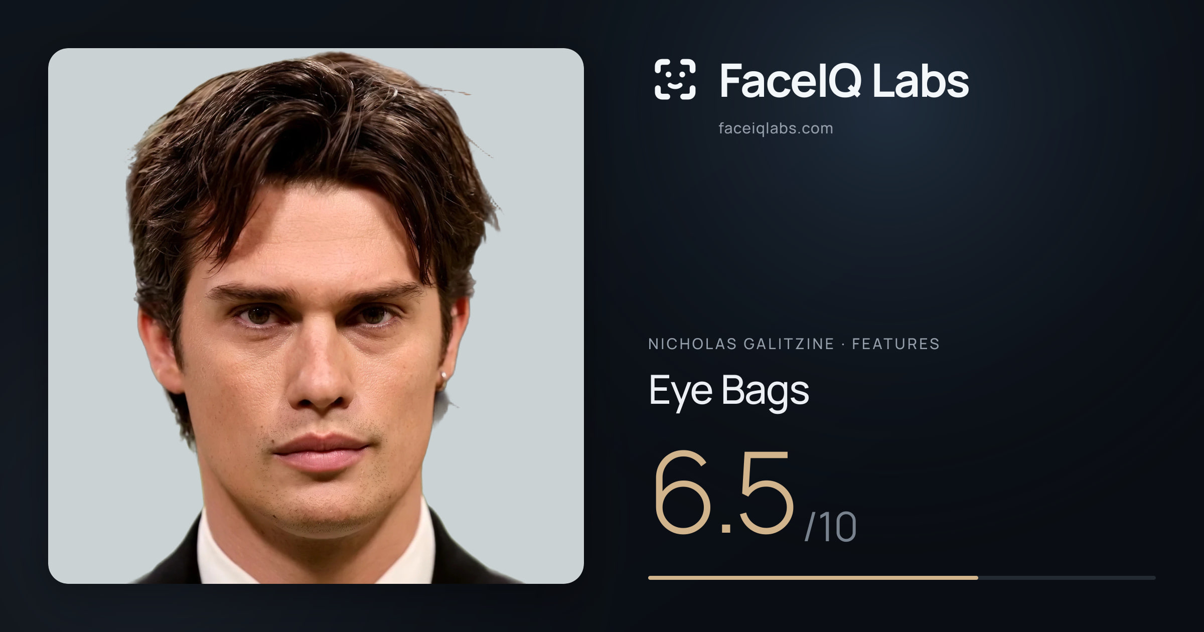 Nicholas Galitzine Eye Bags: 6.5/10, drawn on the photo