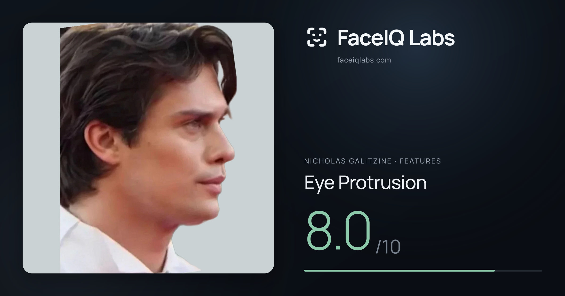 Nicholas Galitzine Eye Protrusion: 8.0/10, drawn on the photo