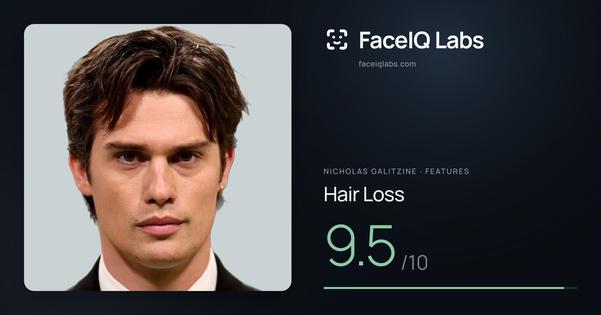 Nicholas Galitzine Hair Loss: 9.5/10, drawn on the photo