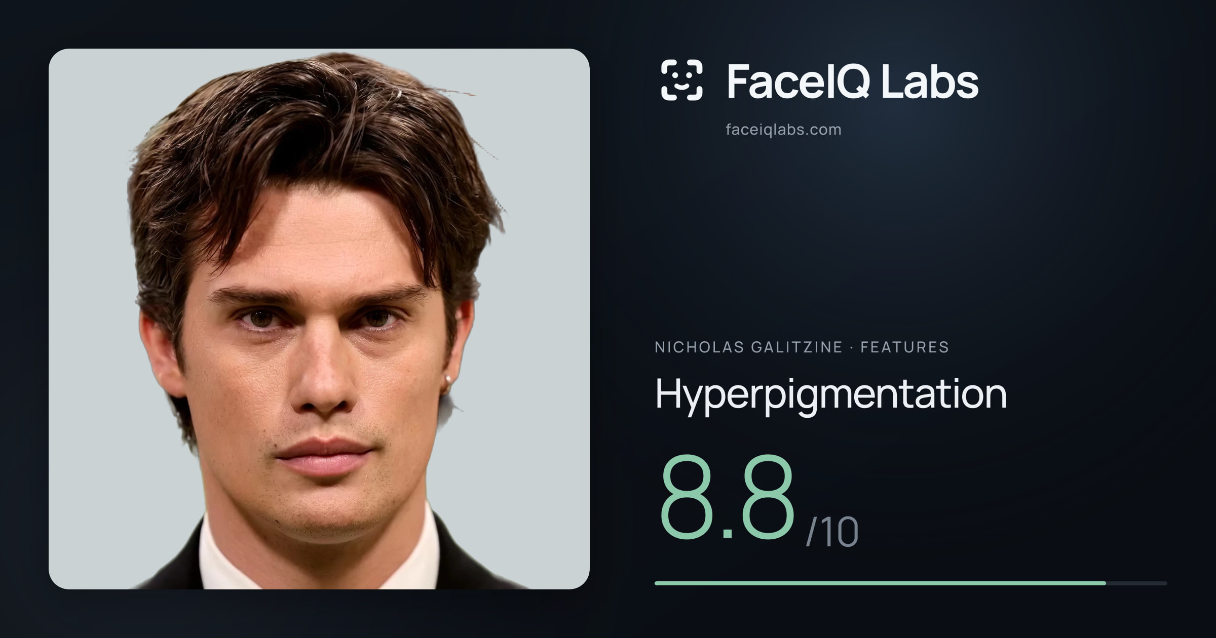 Nicholas Galitzine Hyperpigmentation: 8.8/10, drawn on the photo