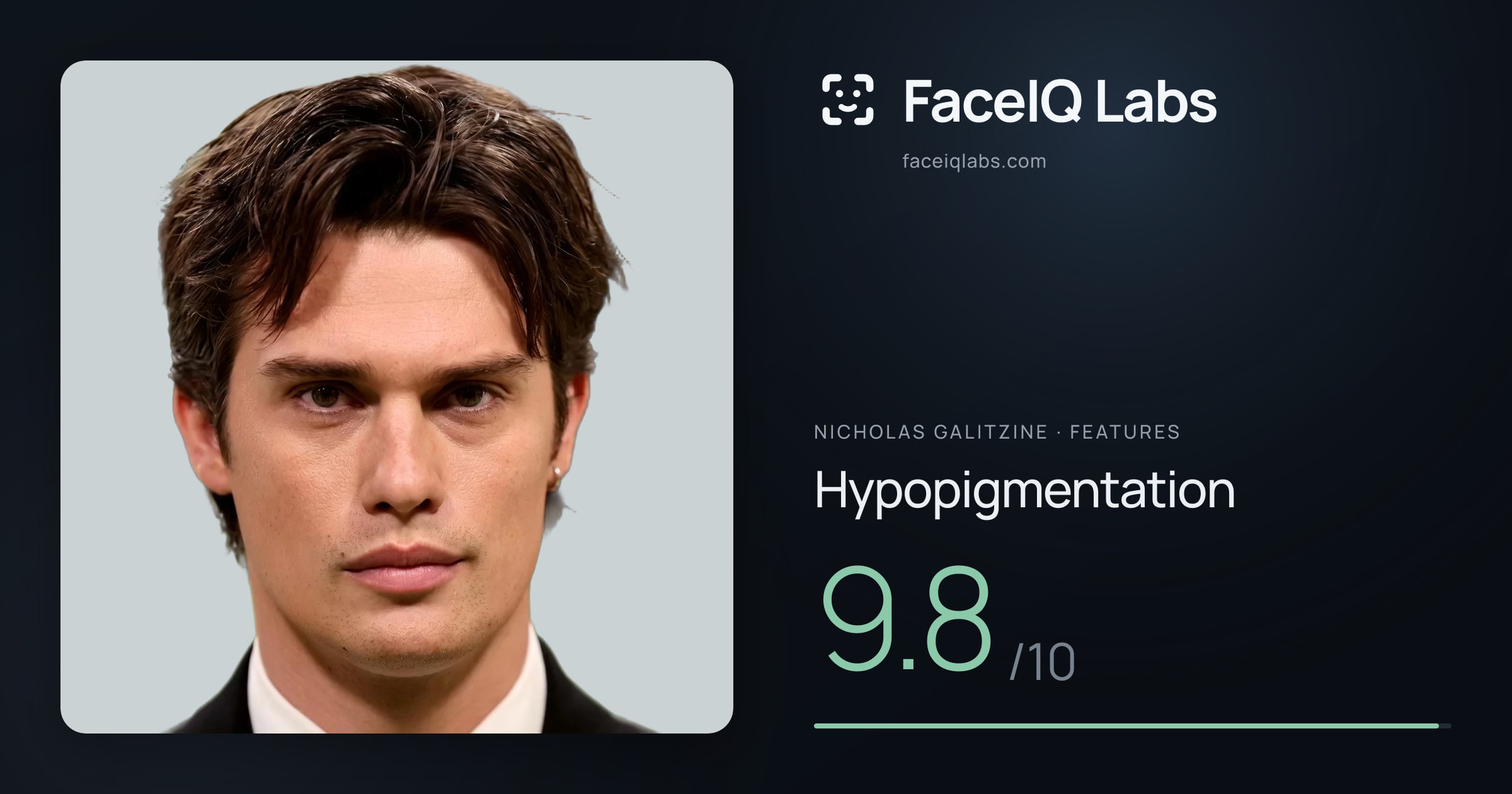 Nicholas Galitzine Hypopigmentation: 9.8/10, drawn on the photo