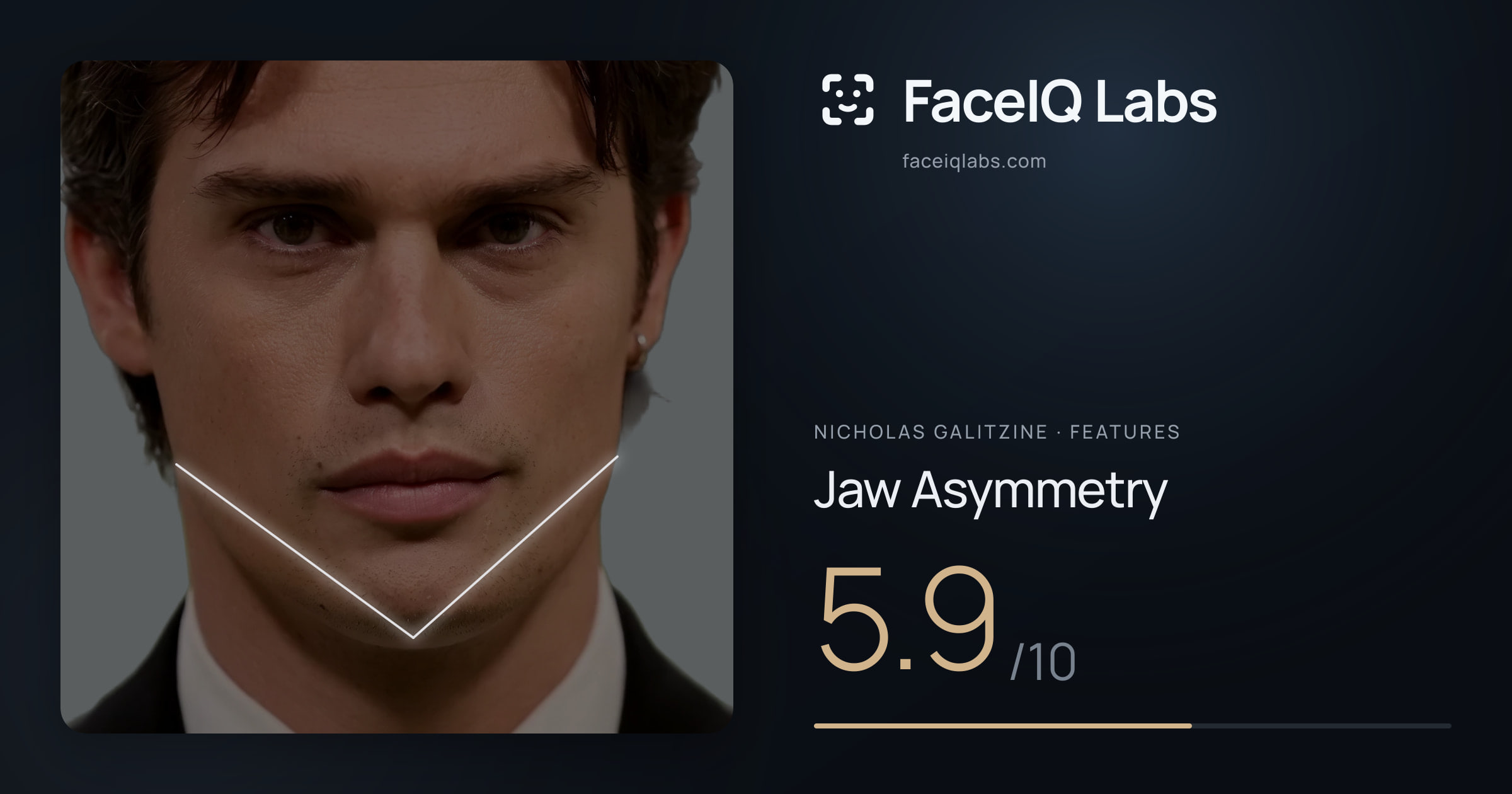 Nicholas Galitzine Jaw Asymmetry: 5.9/10, drawn on the photo