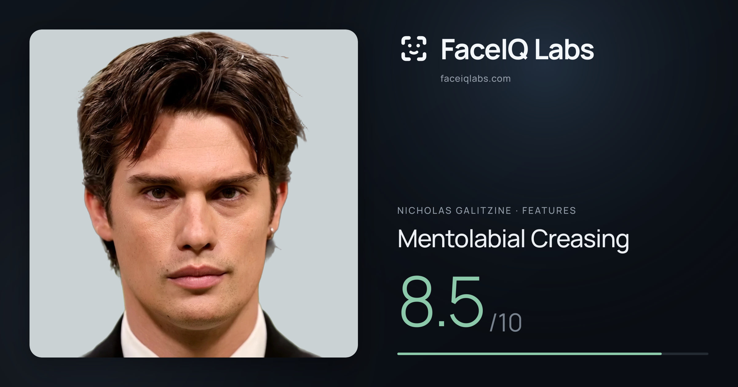 Nicholas Galitzine Mentolabial Creasing: 8.5/10, drawn on the photo