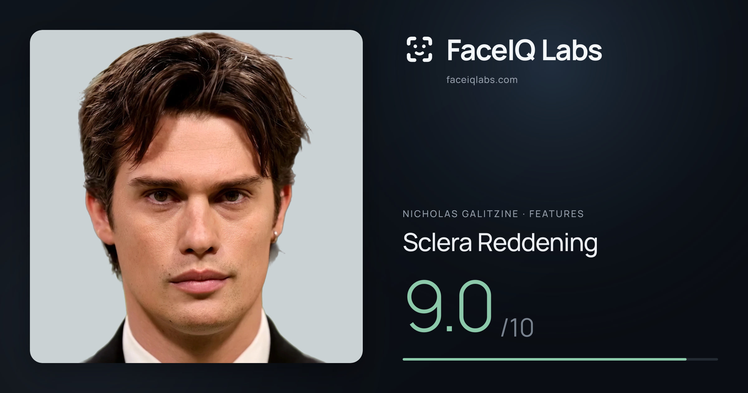 Nicholas Galitzine Sclera Reddening: 9.0/10, drawn on the photo