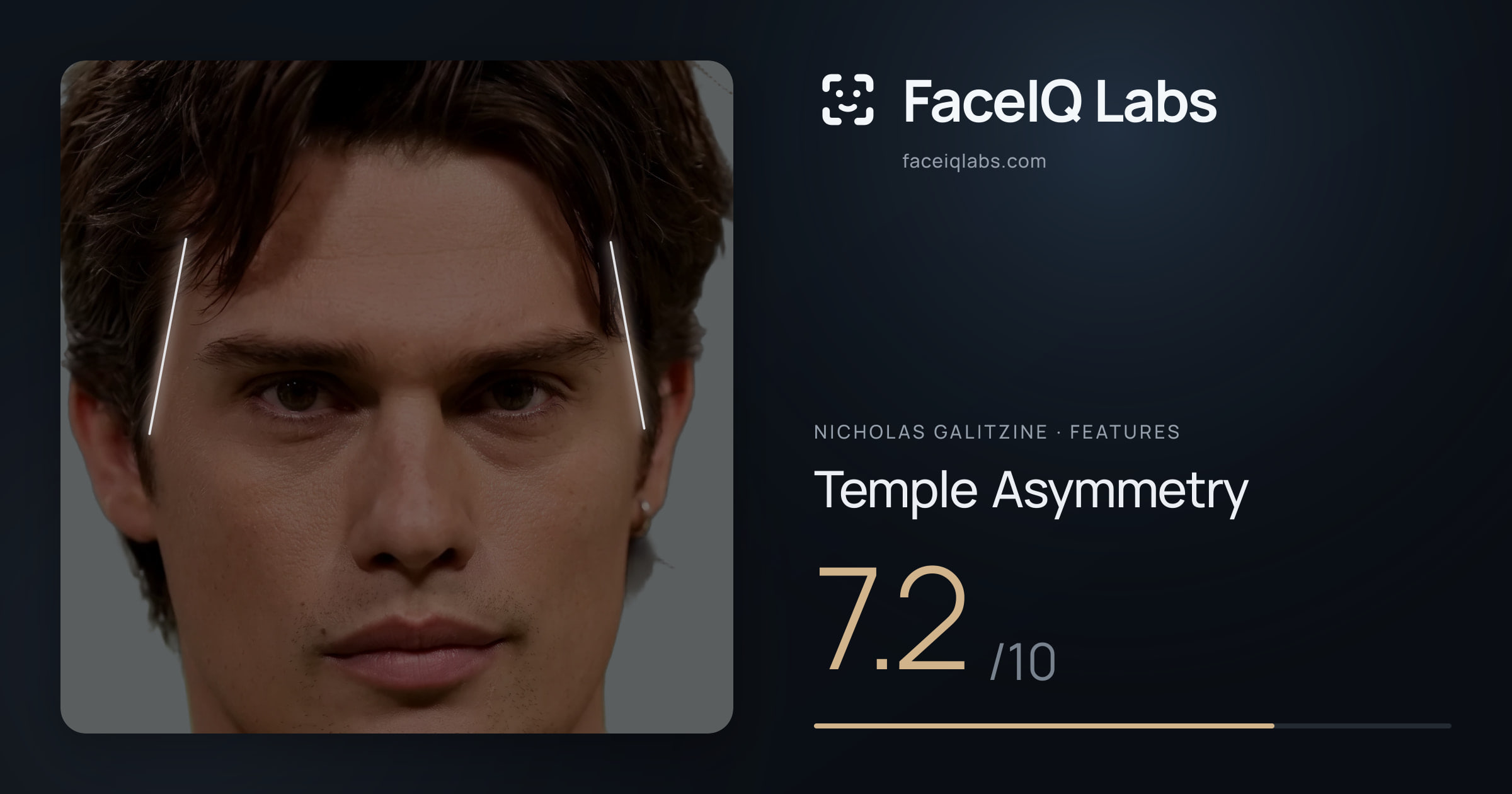 Nicholas Galitzine Temple Asymmetry: 7.2/10, drawn on the photo