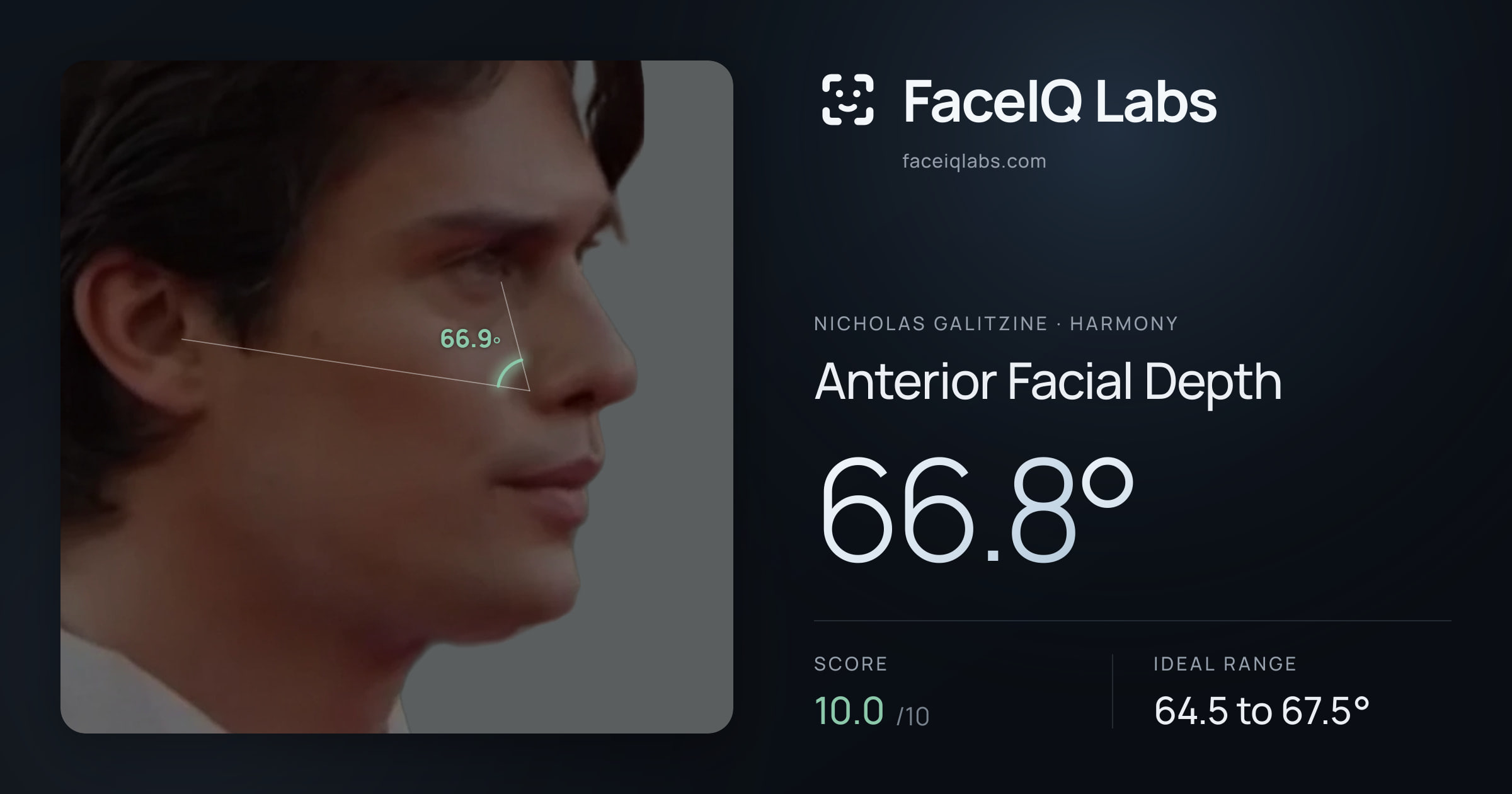 Nicholas Galitzine Anterior Facial Depth: 66.8°, drawn on the photo