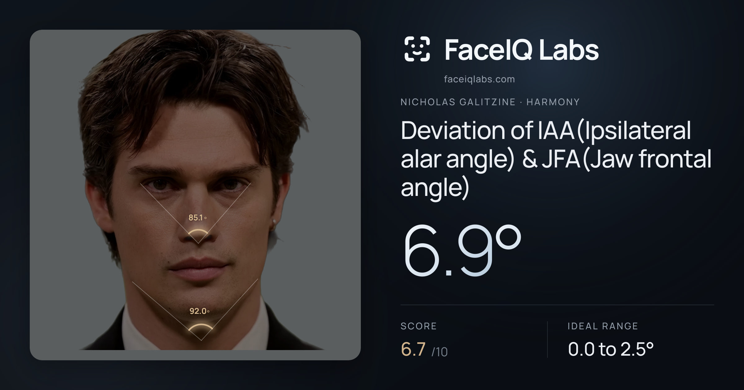 Nicholas Galitzine Deviation of IAA(Ipsilateral alar angle) & JFA(Jaw frontal angle): 6.9°, drawn on the photo