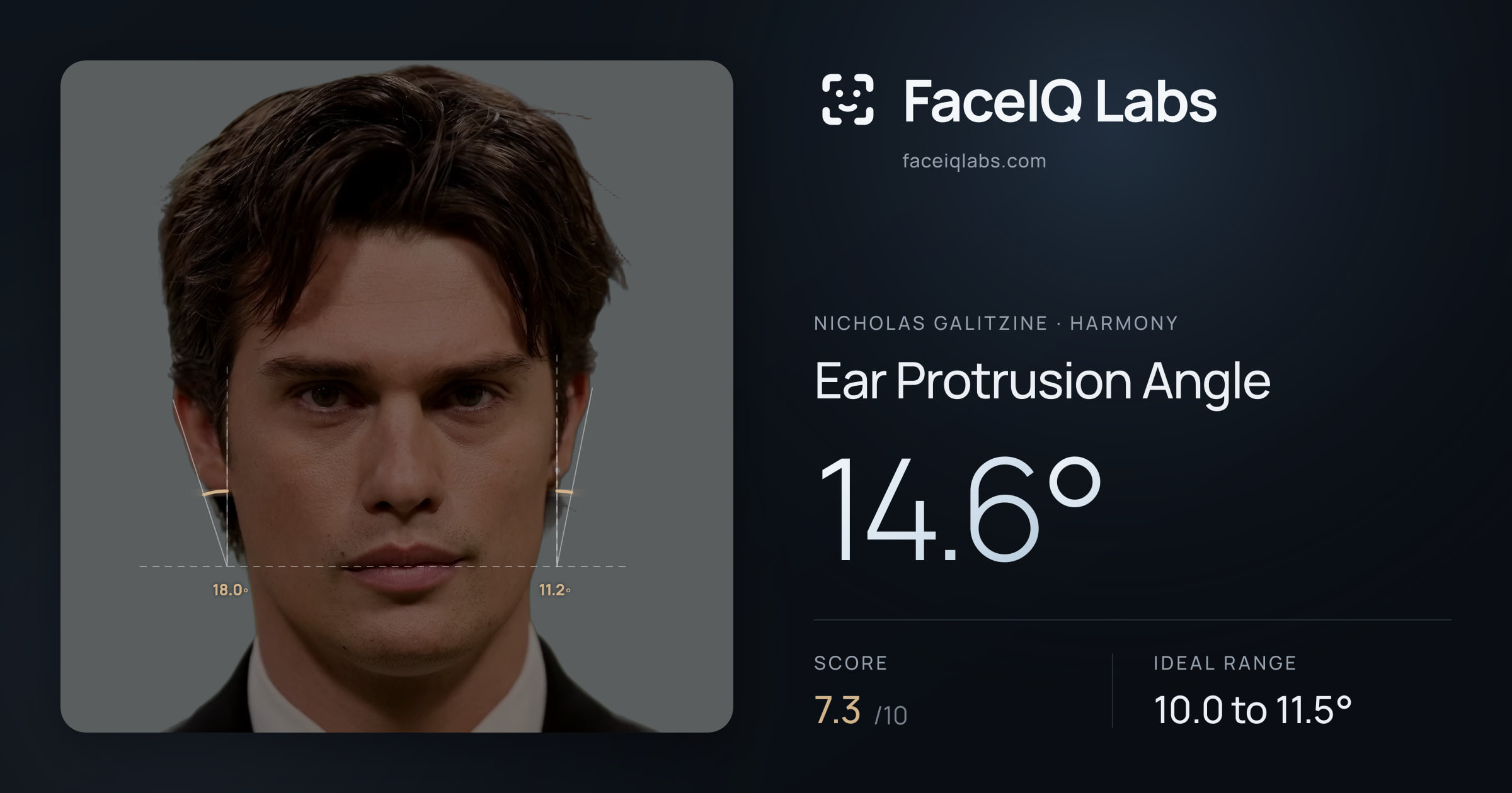 Nicholas Galitzine Ear Protrusion Angle: 14.6°, drawn on the photo