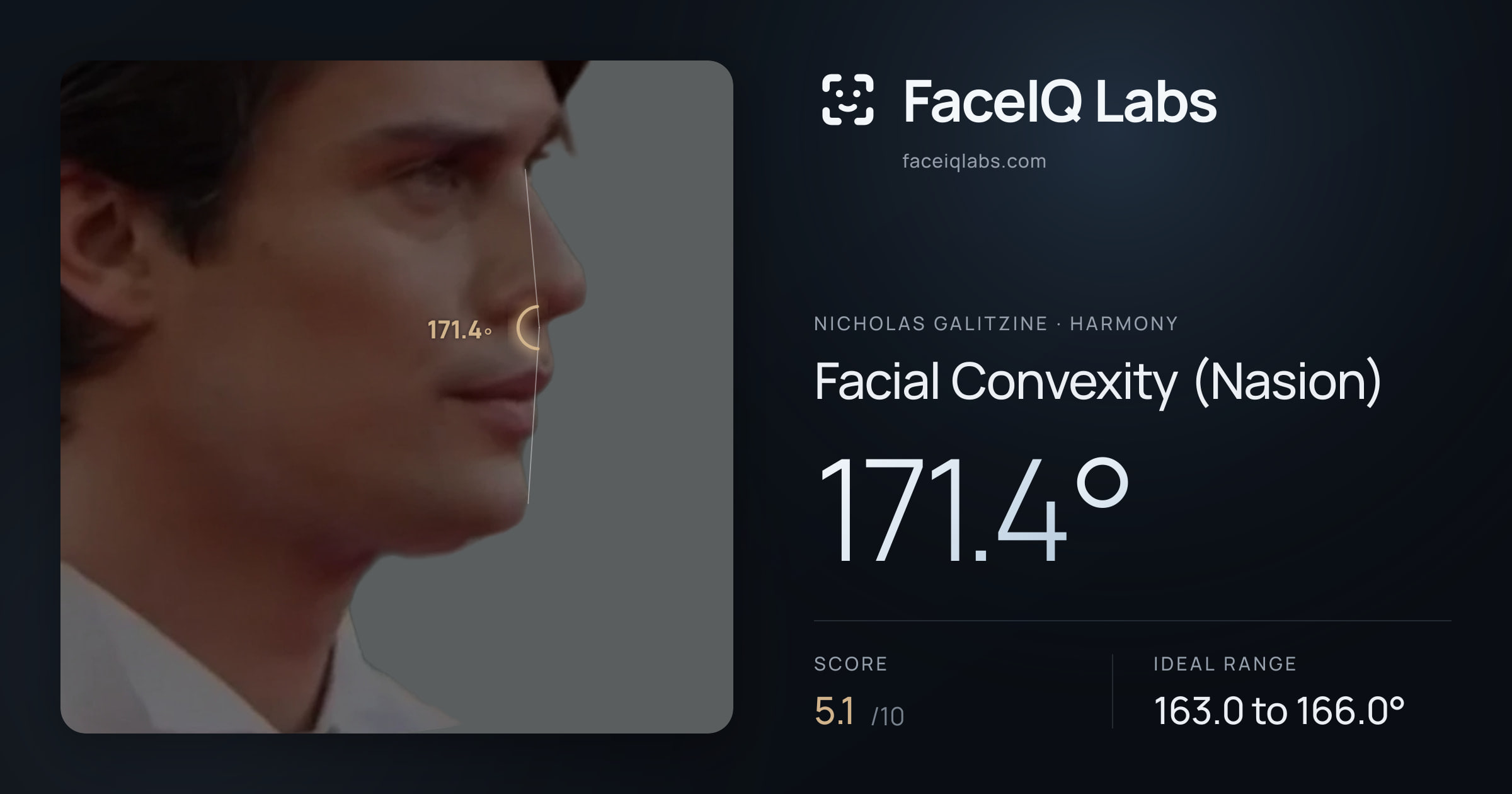 Nicholas Galitzine Facial Convexity (Nasion): 171.4°, drawn on the photo