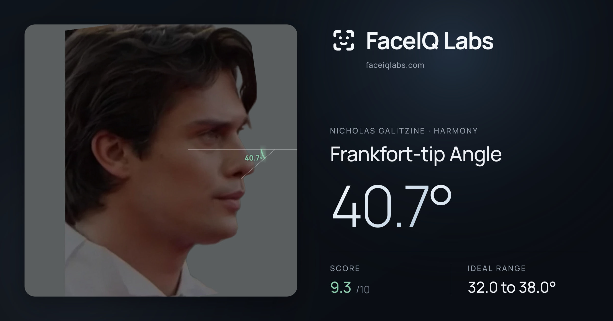 Nicholas Galitzine Frankfort-tip Angle: 40.7°, drawn on the photo
