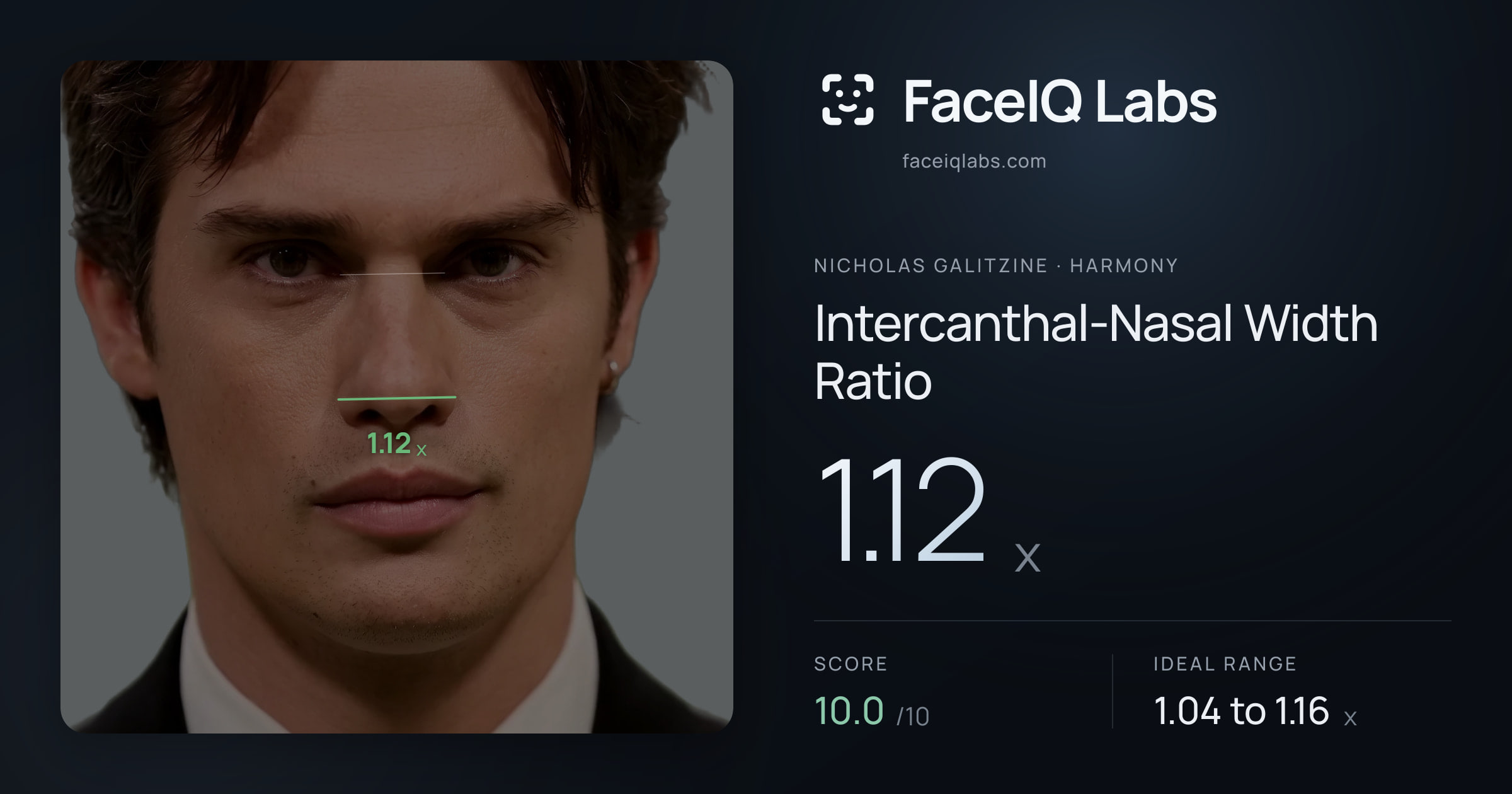 Nicholas Galitzine Intercanthal-Nasal Width Ratio: 1.12x, drawn on the photo
