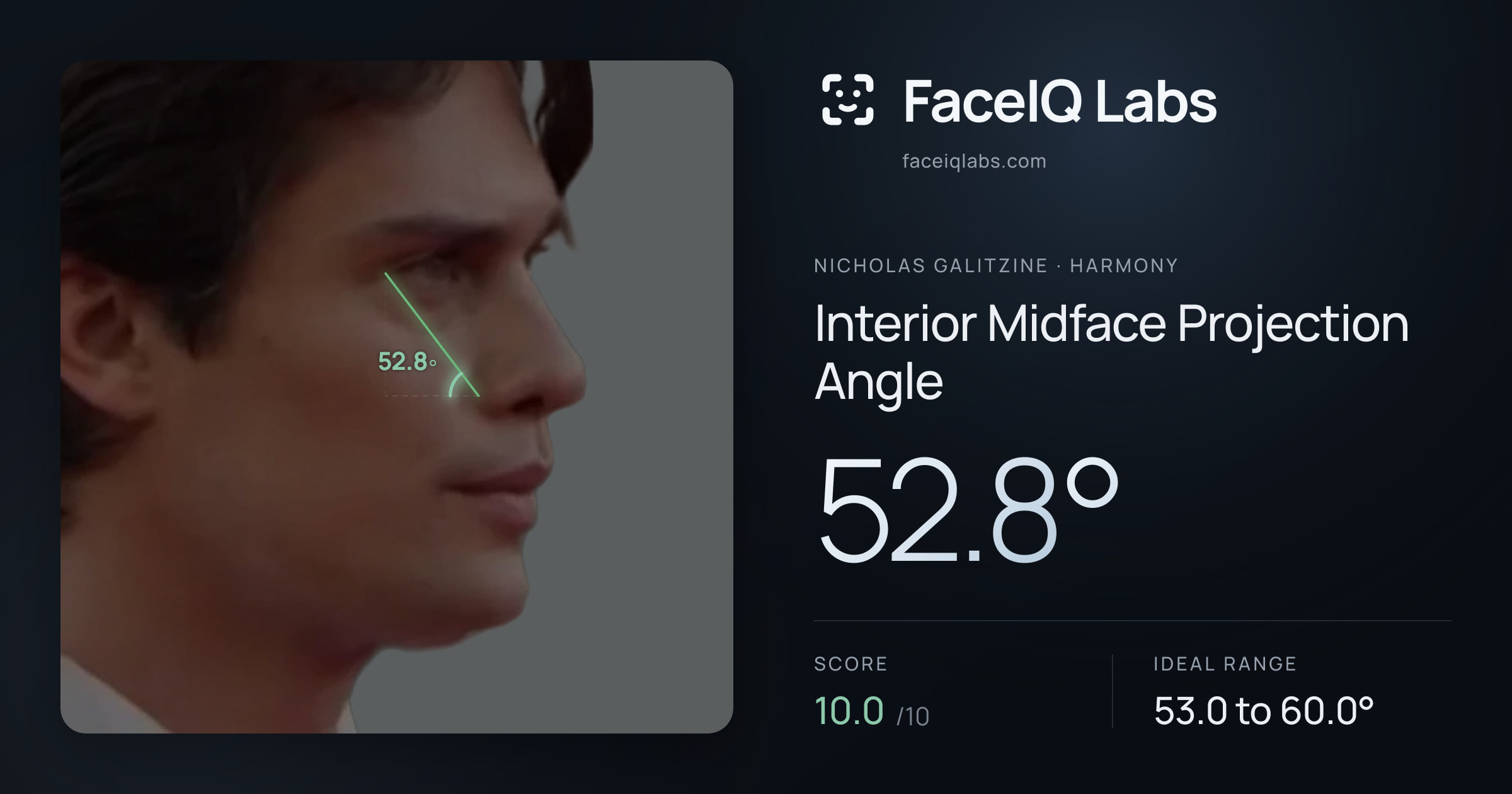Nicholas Galitzine Interior Midface Projection Angle: 52.8°, drawn on the photo